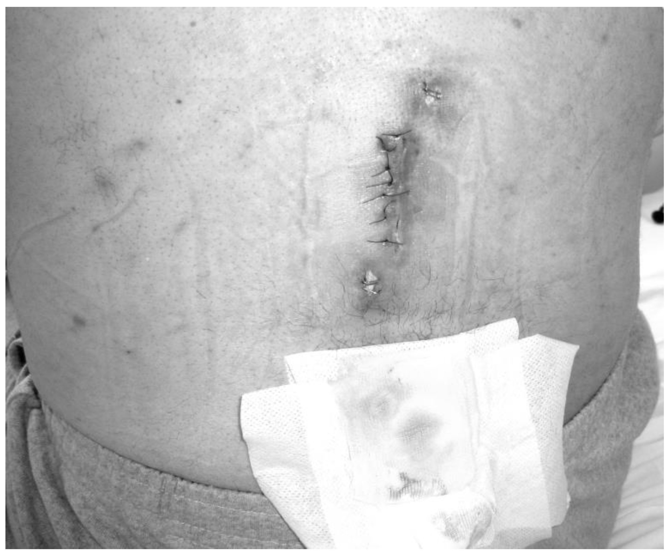 Medicina 55 00164 g001