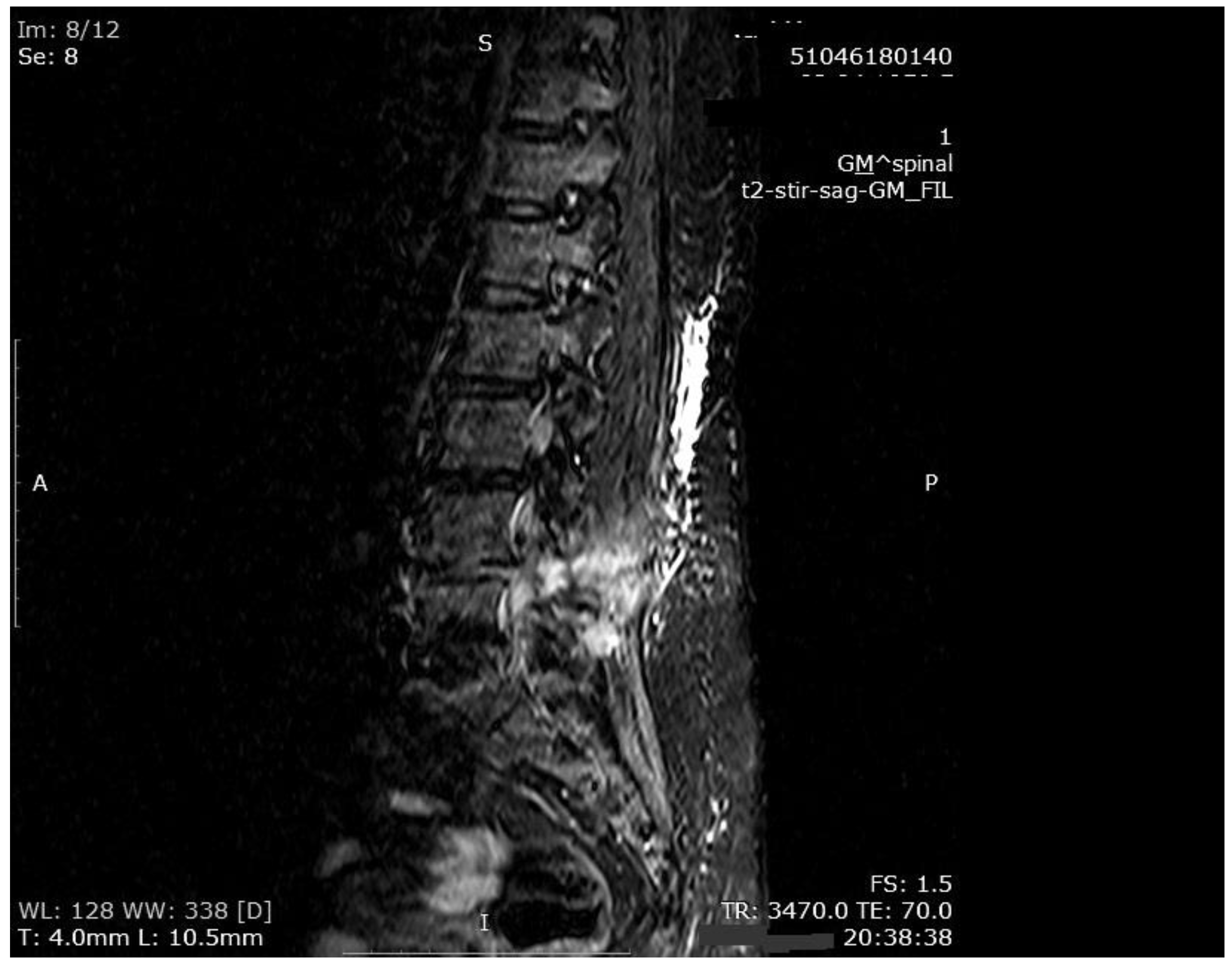Medicina 55 00164 g004