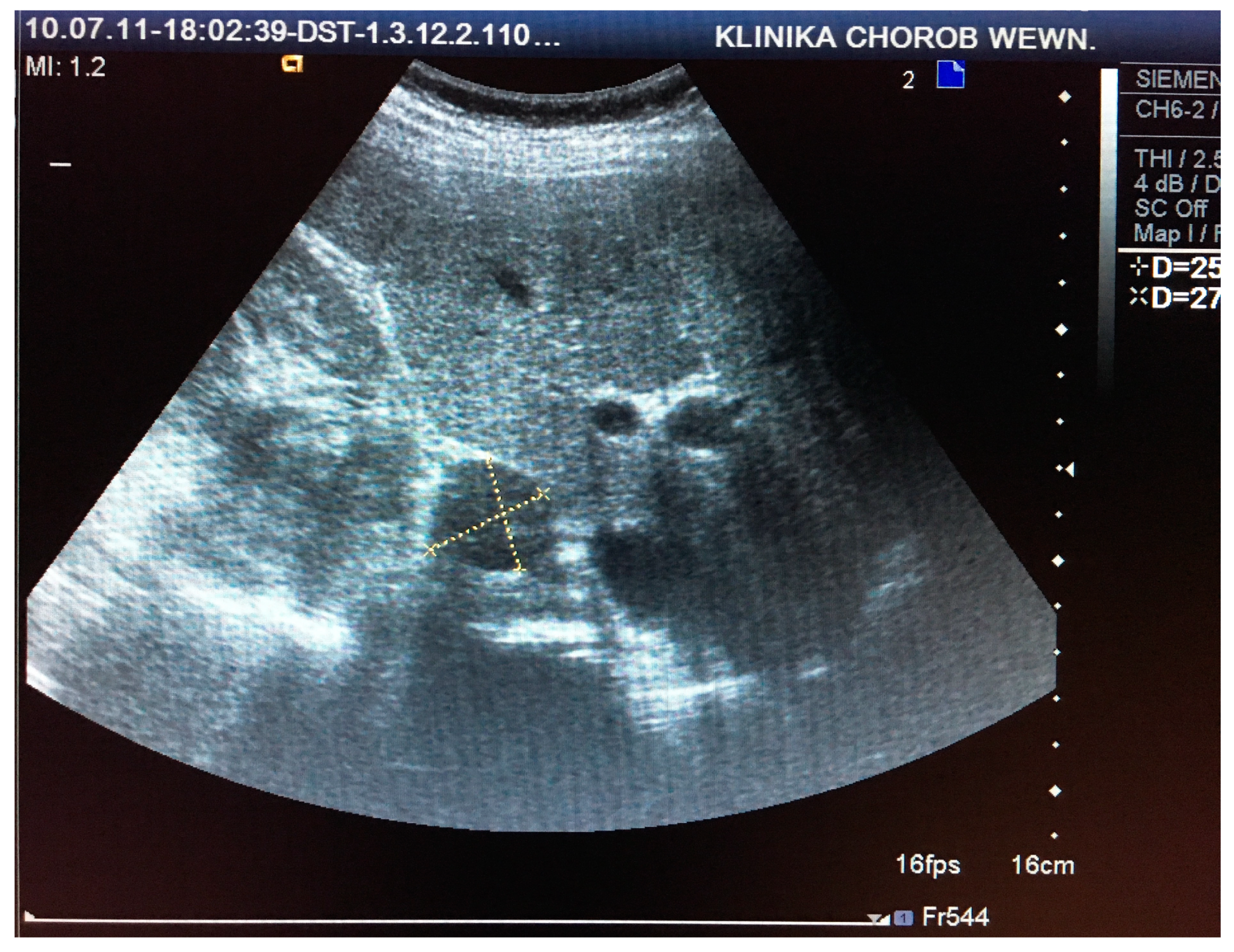 Medicina 55 00165 g001