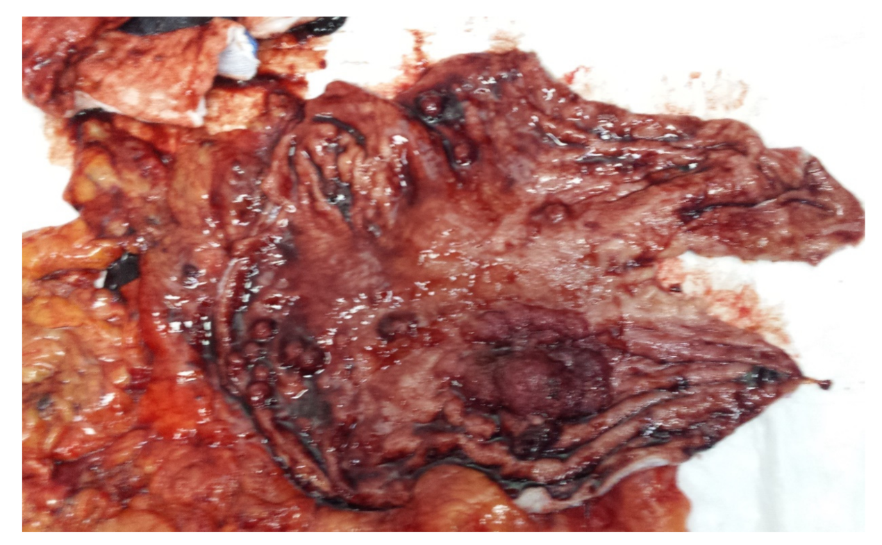 Medicina 55 00242 g002