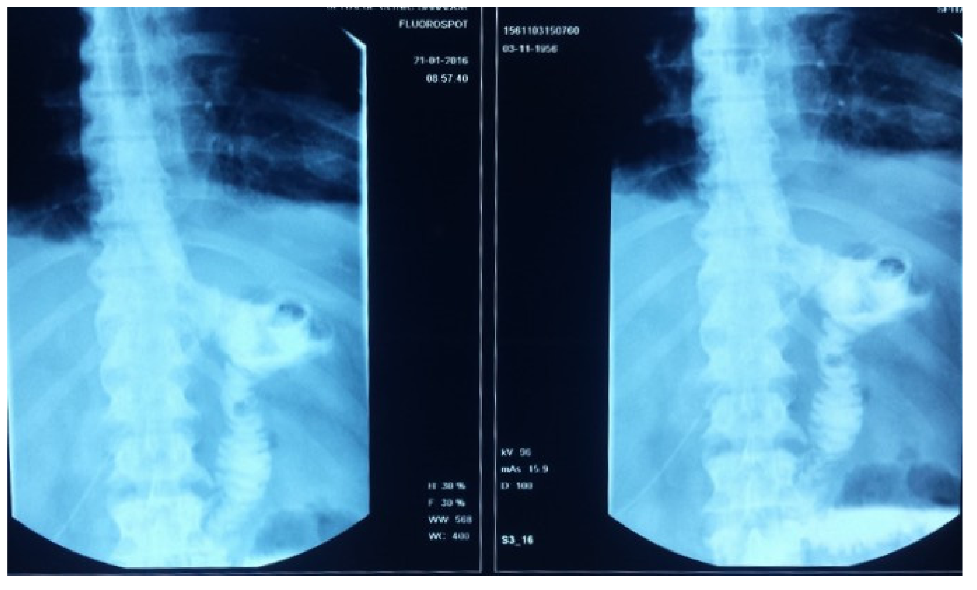 Medicina 55 00242 g004