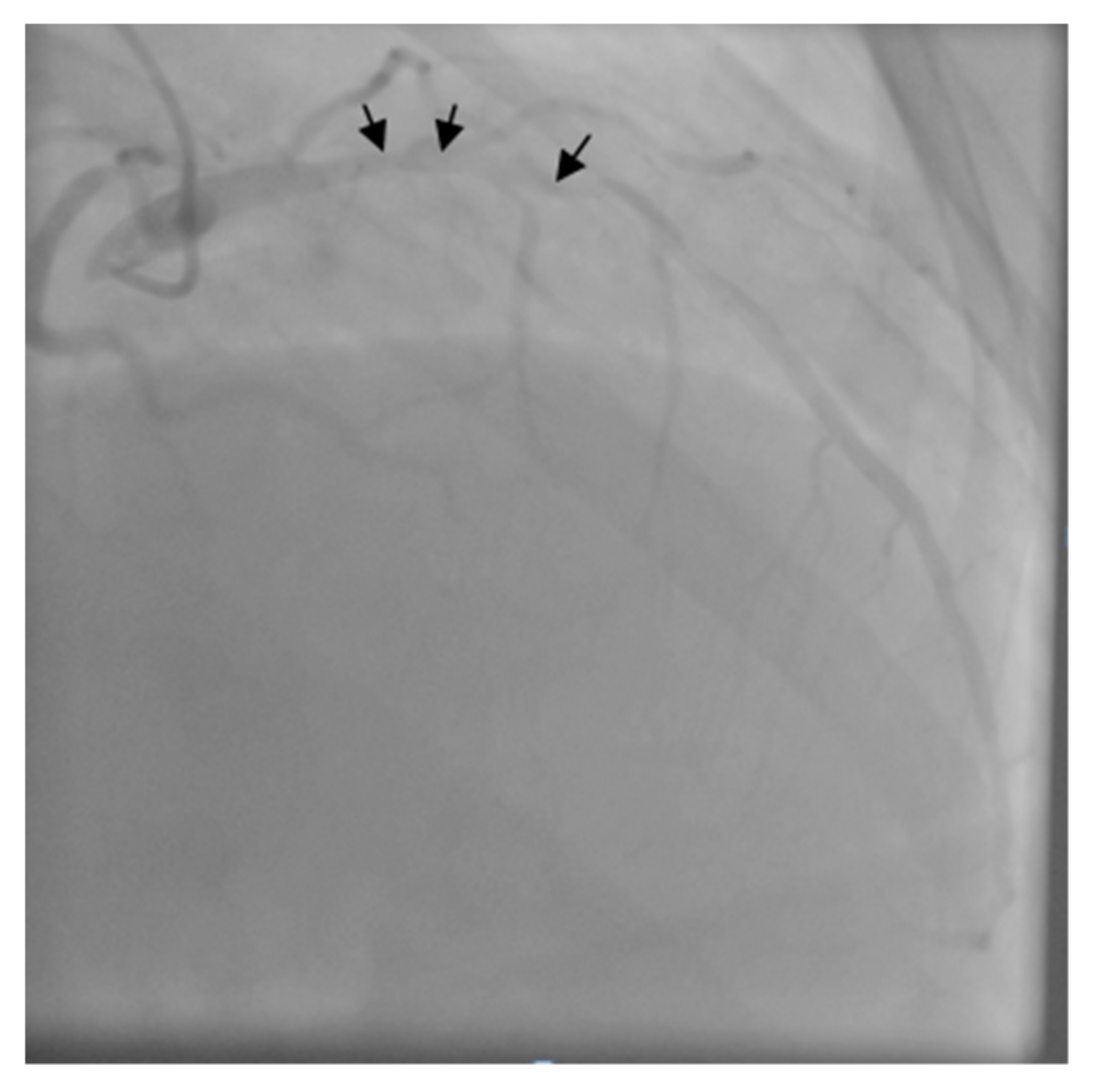 Medicina 55 00242 g005