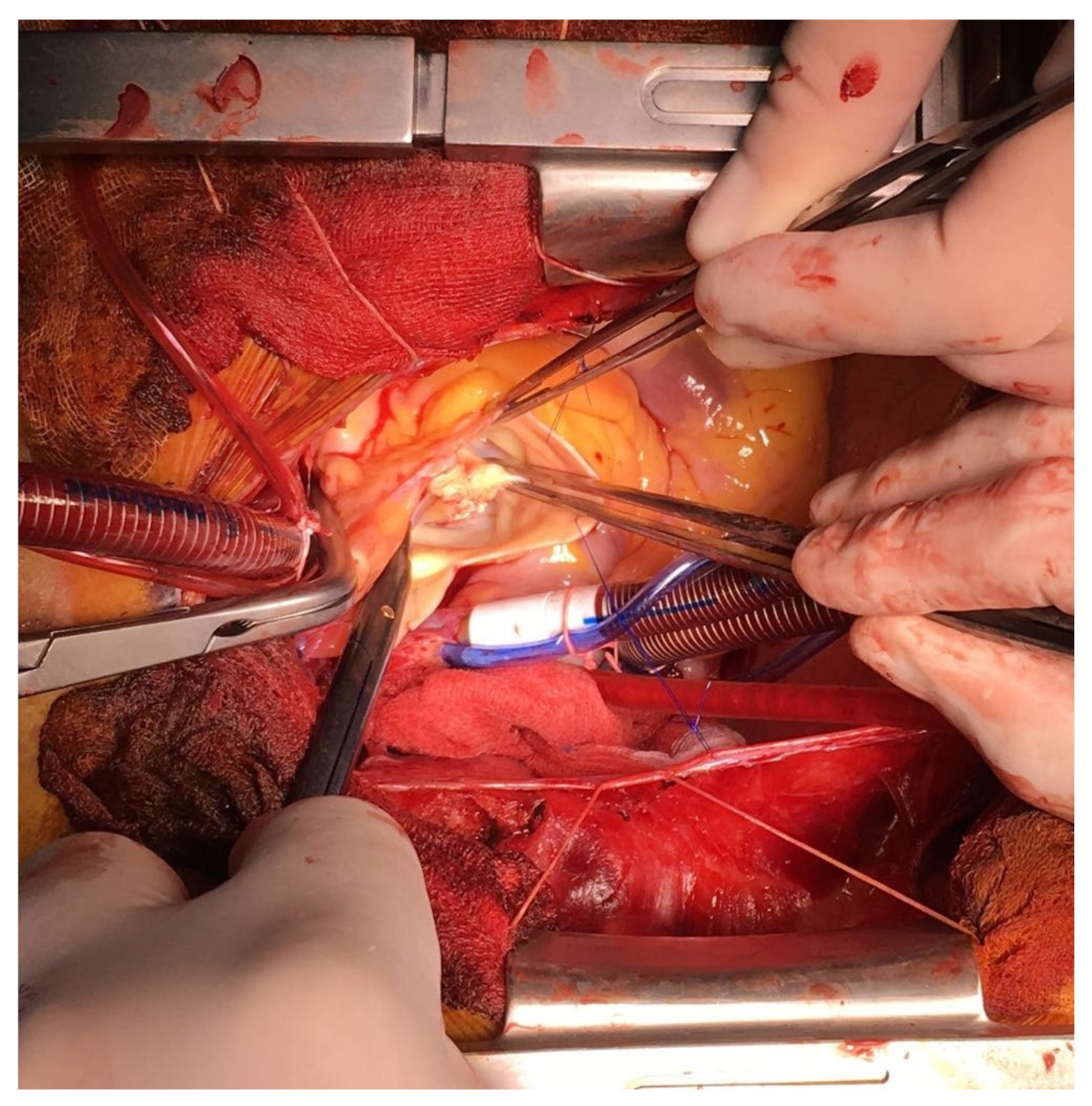 Medicina 55 00242 g008