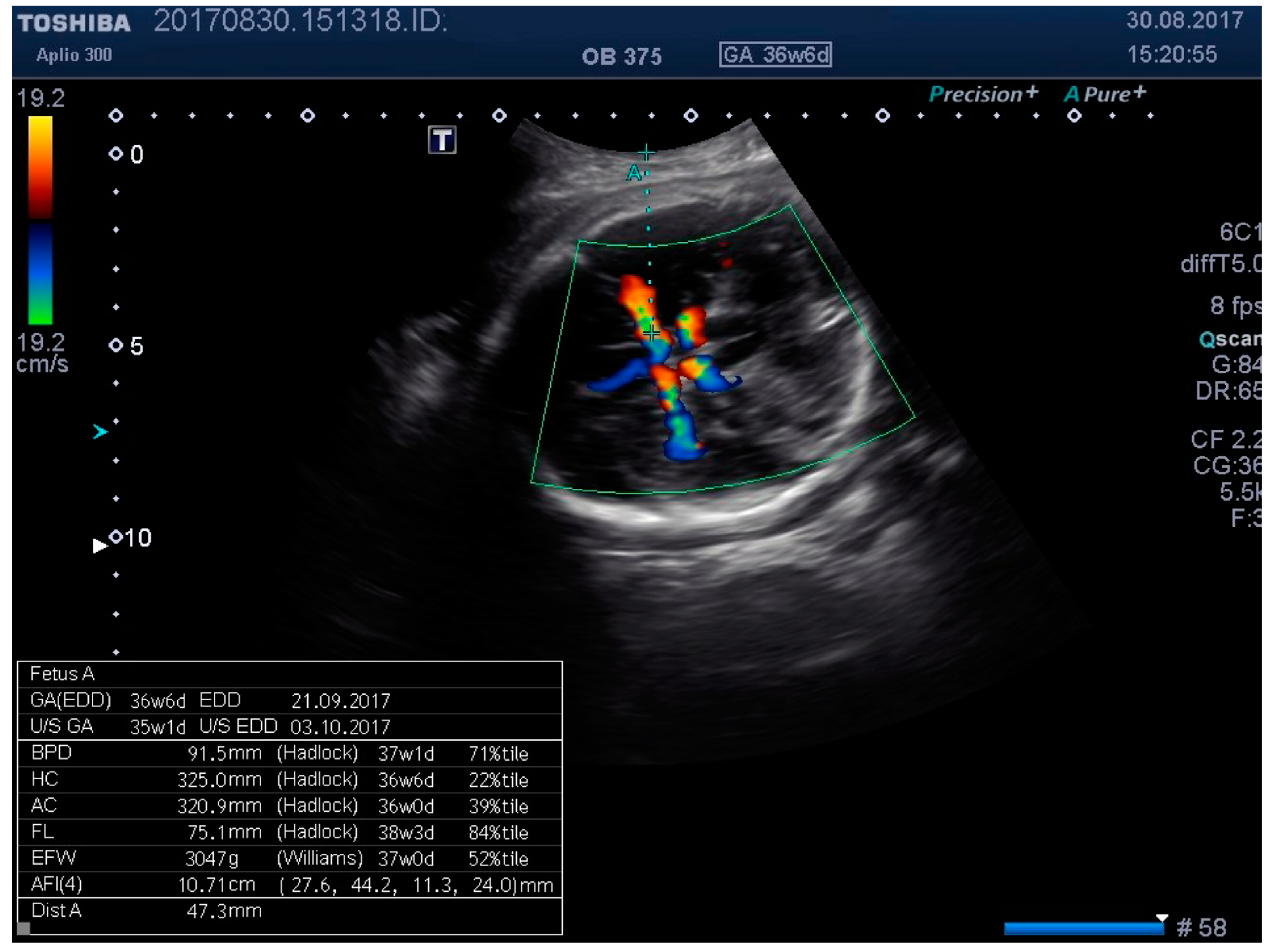 Medicina 55 00410 g004