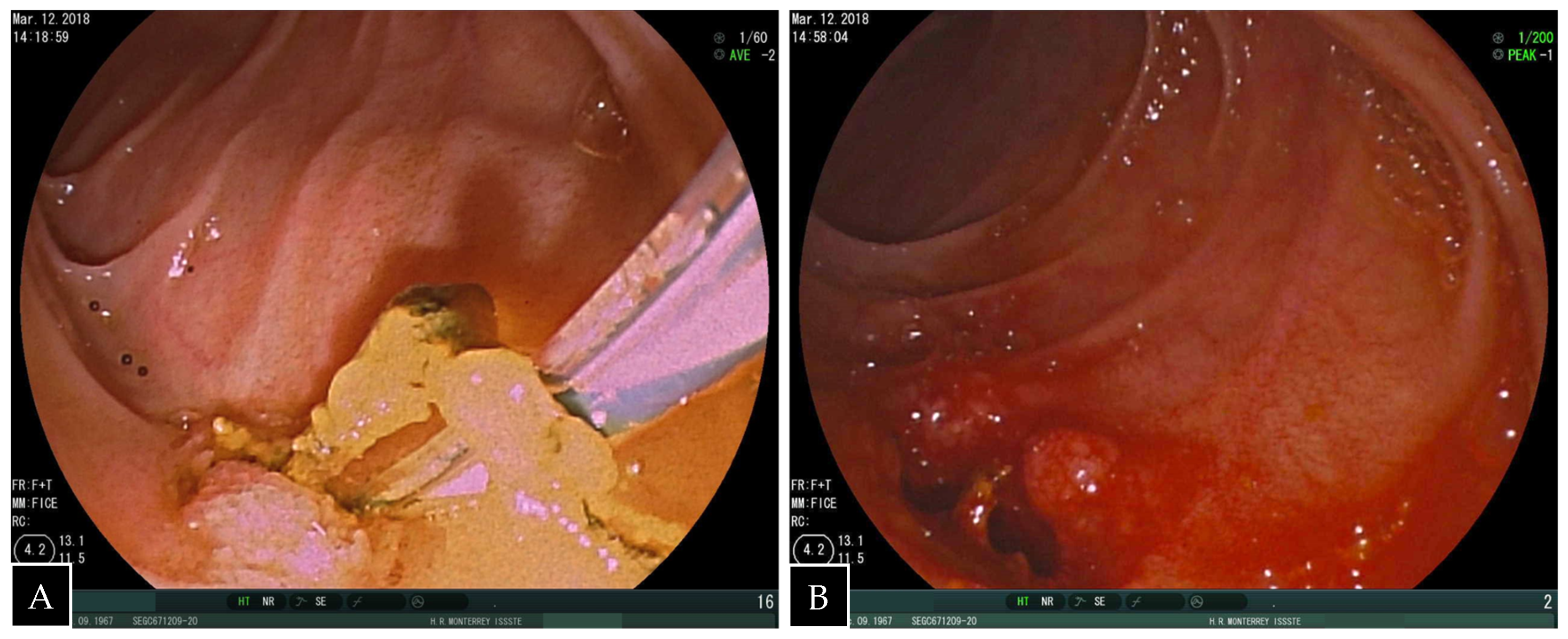 Medicina 55 00483 g004