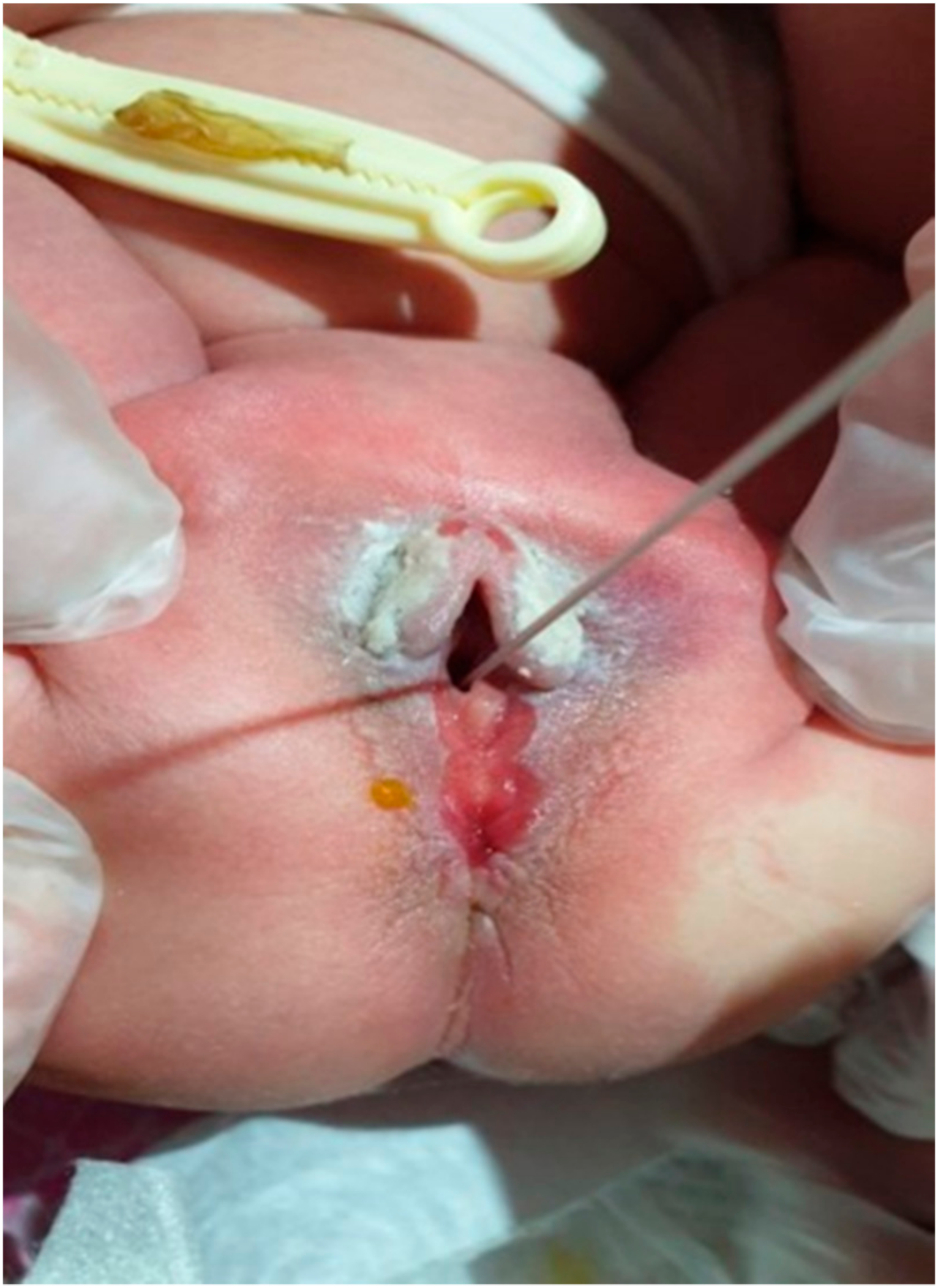 Medicina 55 00488 g004