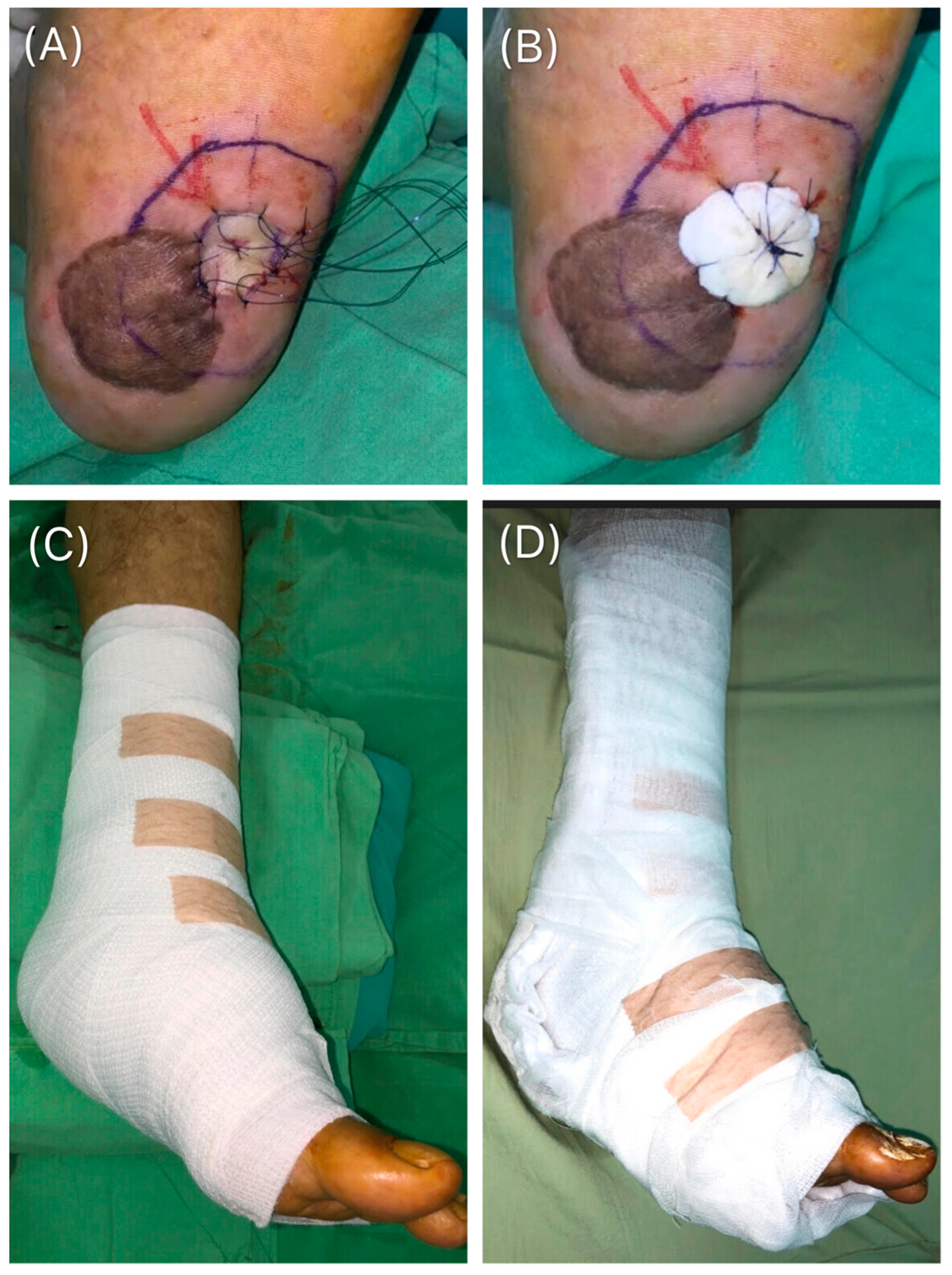 Medicina 55 00781 g002