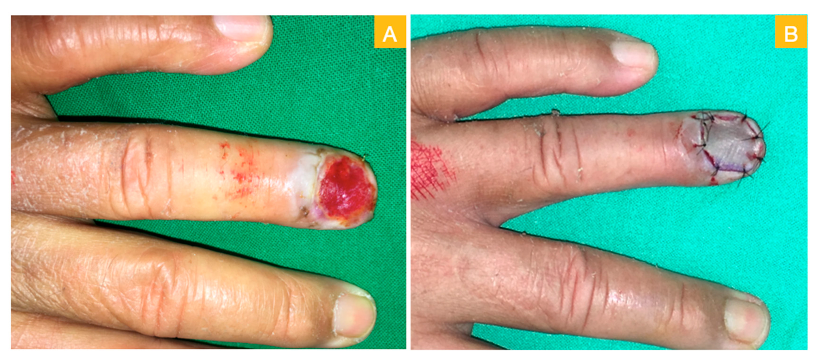 Medicina 56 00017 g002 Medicina 56 00017 g002