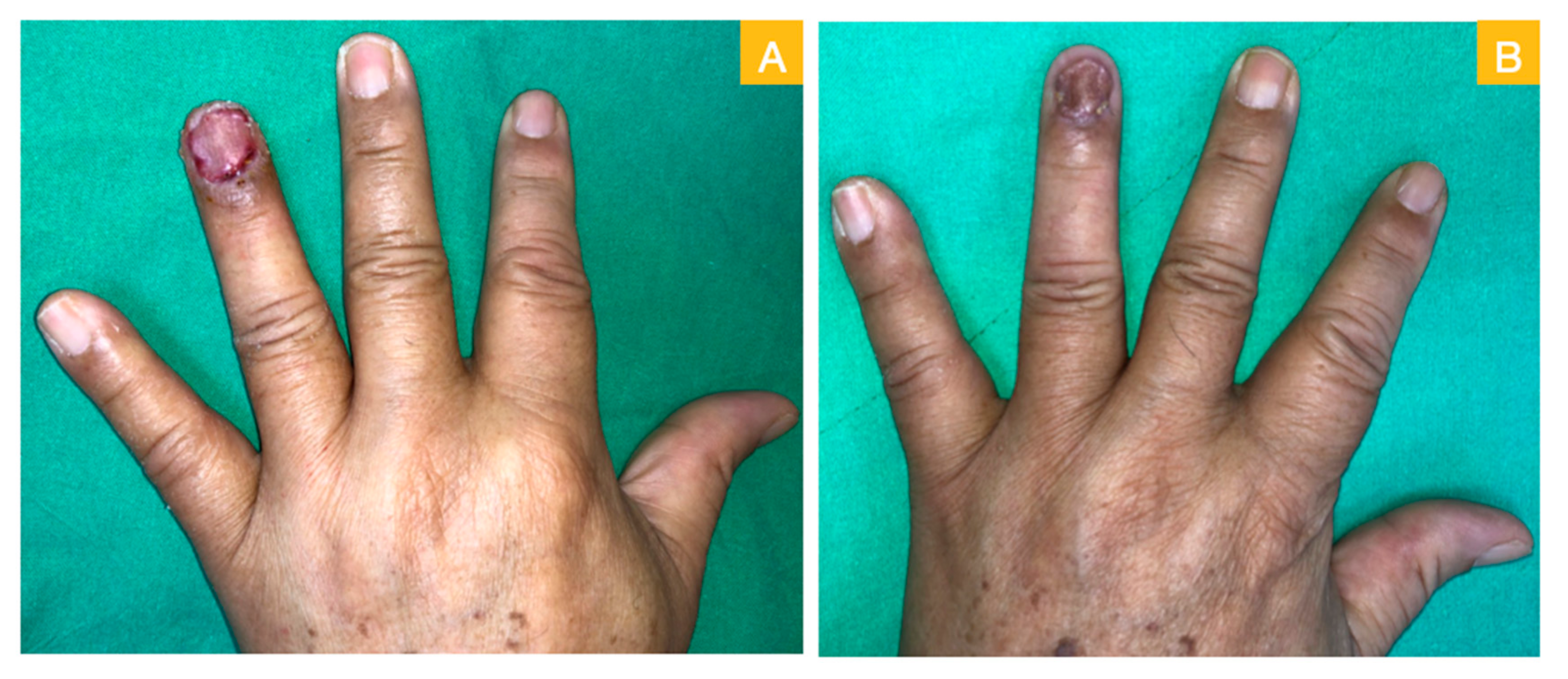 Medicina 56 00017 g003 Medicina 56 00017 g003