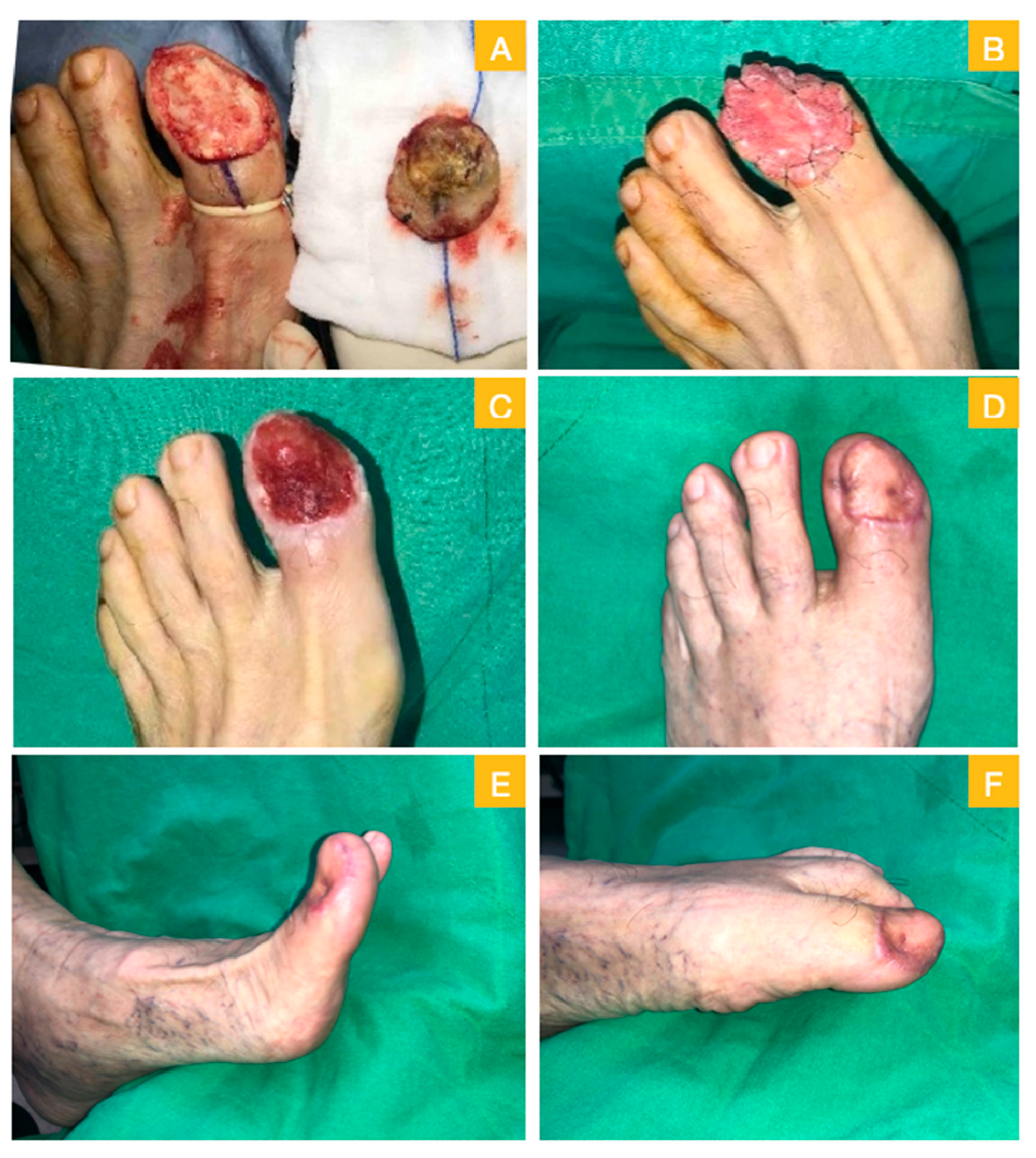 Medicina 56 00017 g004 Medicina 56 00017 g004