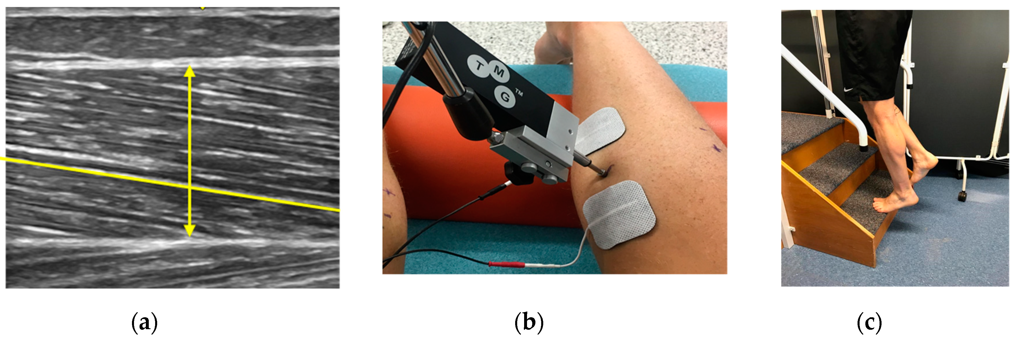 Medicina 56 00021 g002 Medicina 56 00021 g002