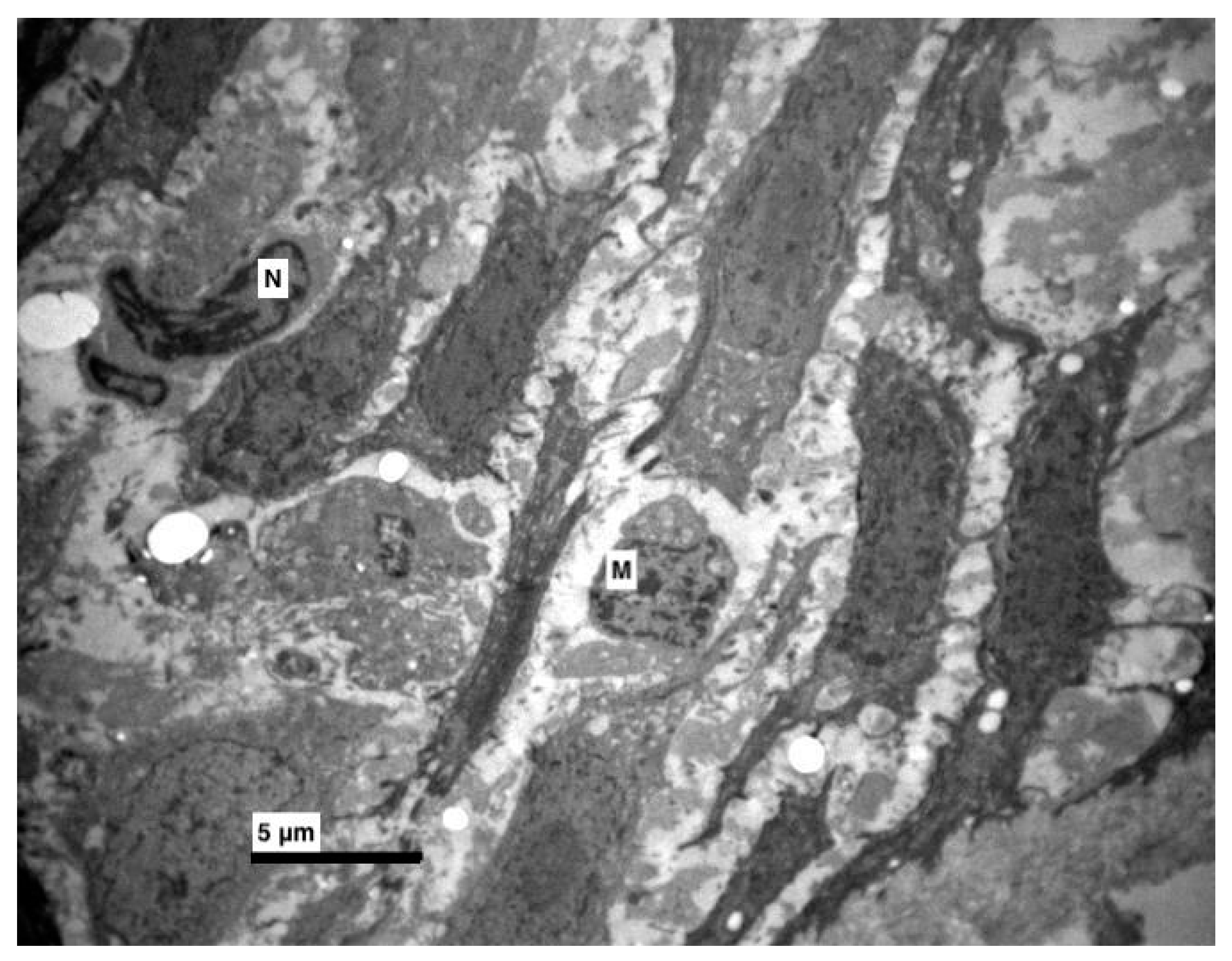 Medicina 56 00051 g005