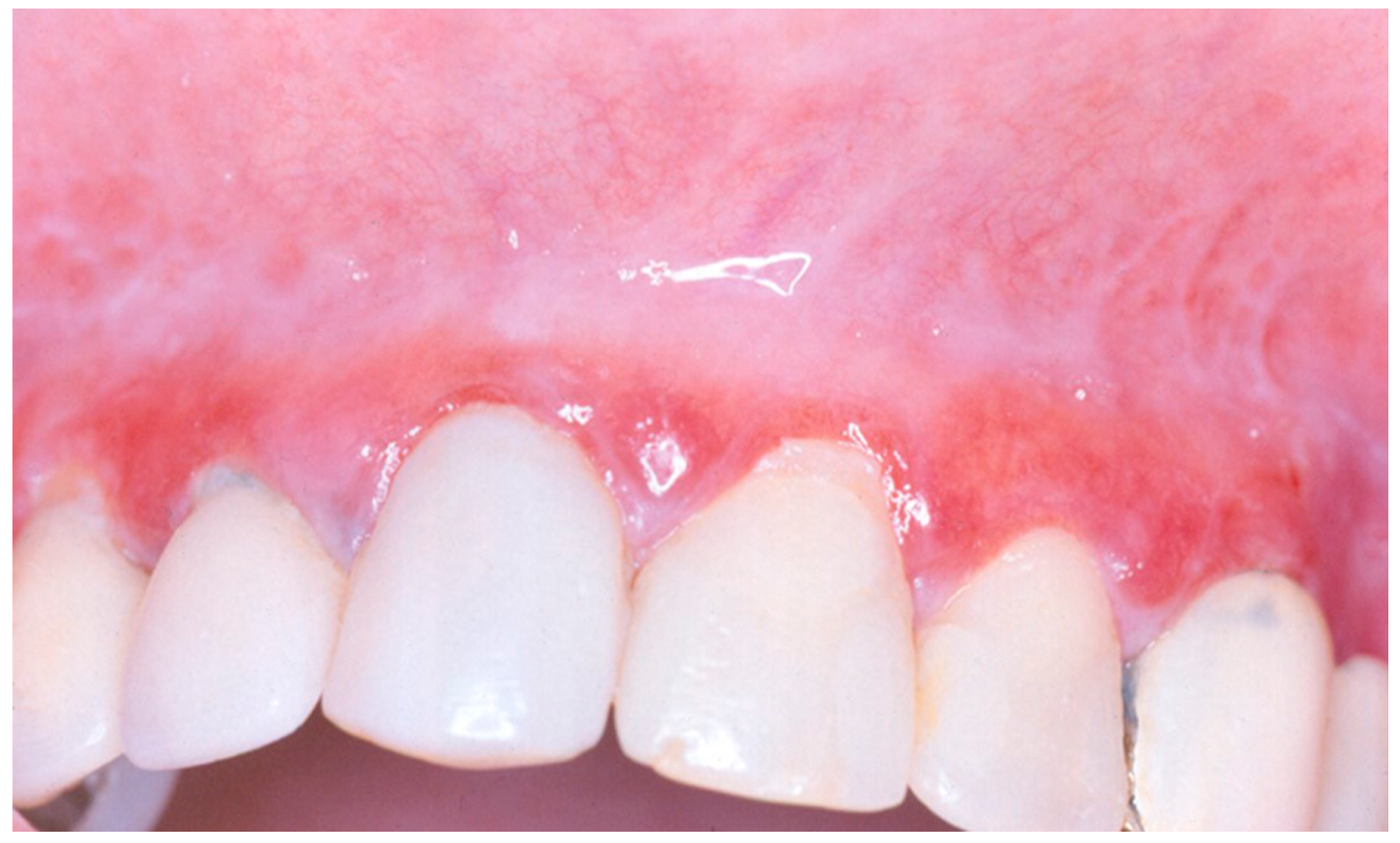 Medicina 56 00053 g002