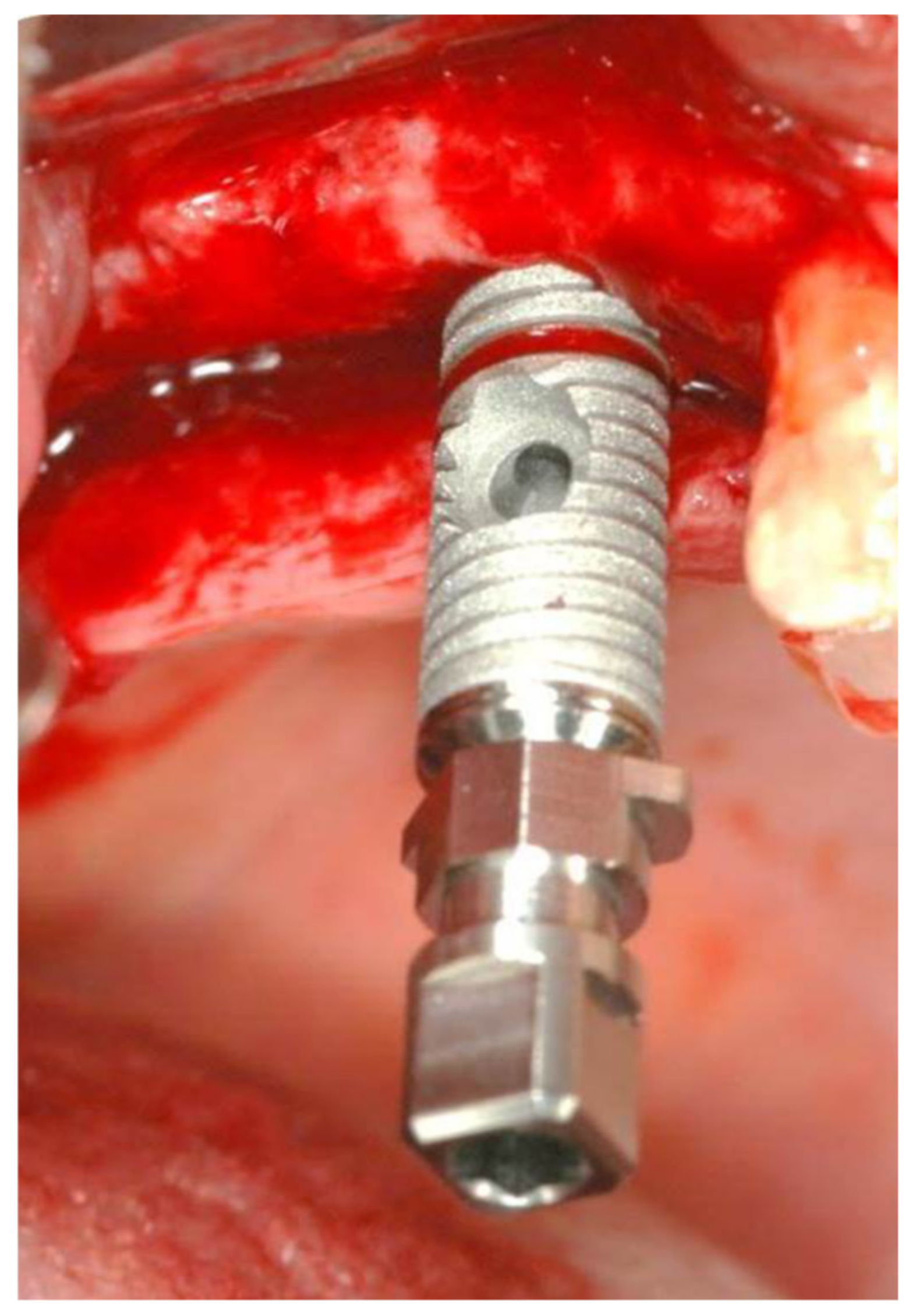 Medicina 56 00075 g002