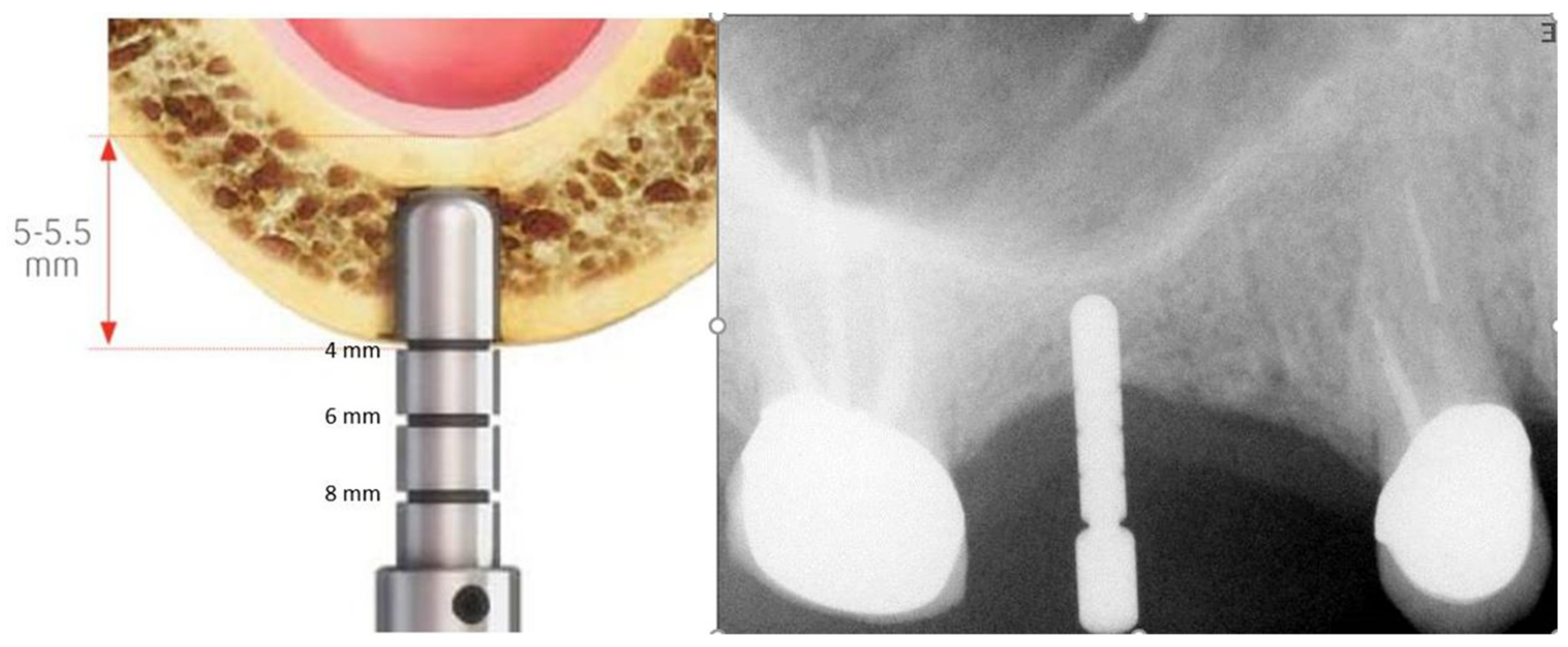 Medicina 56 00075 g003
