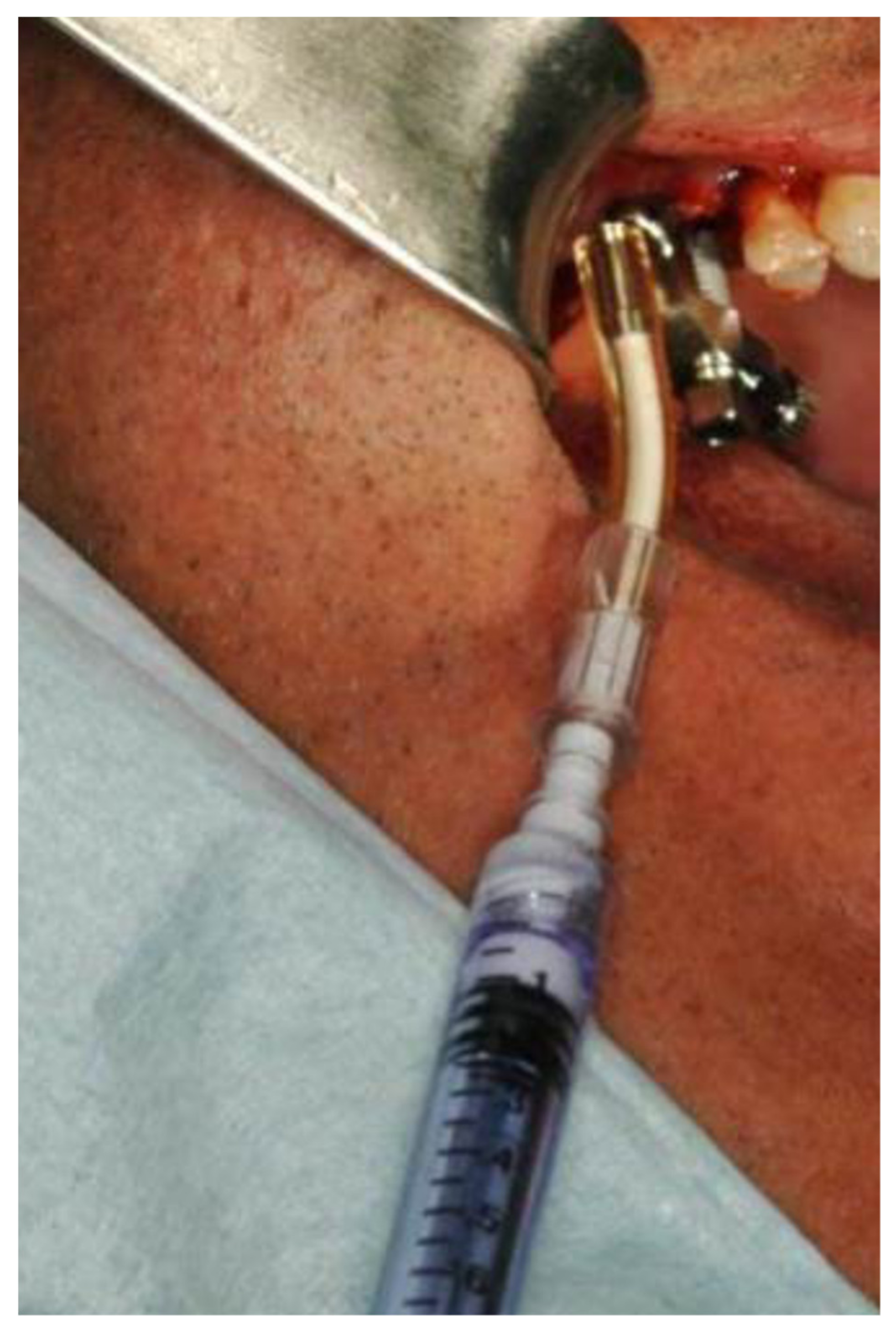 Medicina 56 00075 g004