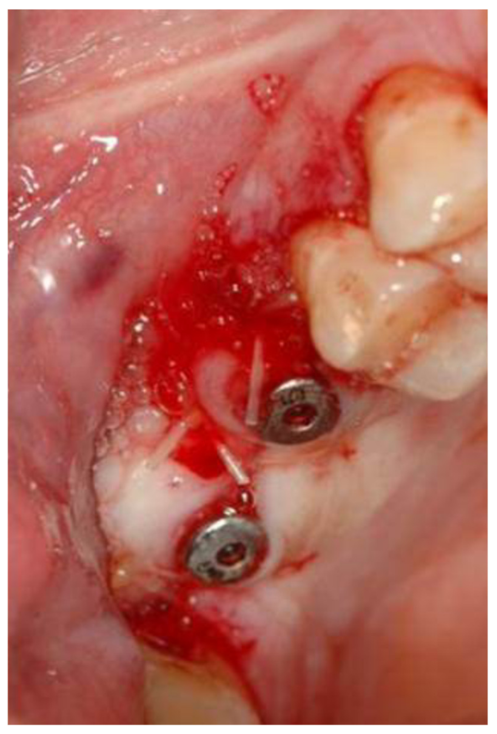 Medicina 56 00075 g006