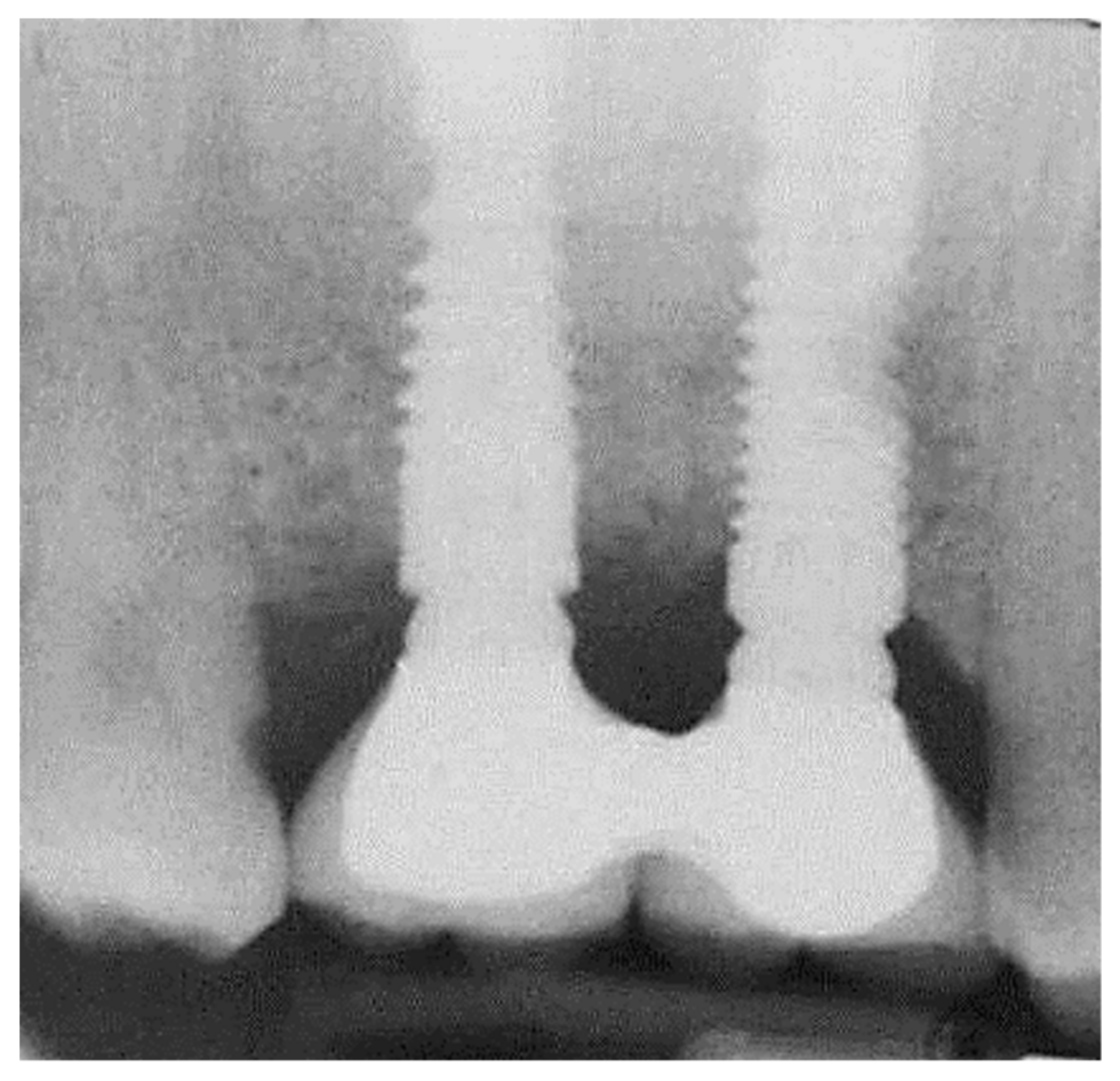 Medicina 56 00075 g007