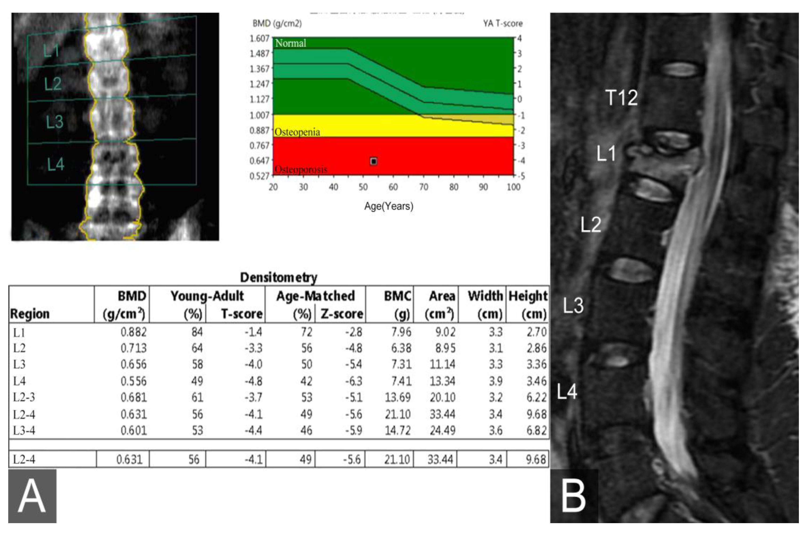 Medicina 56 00082 g001