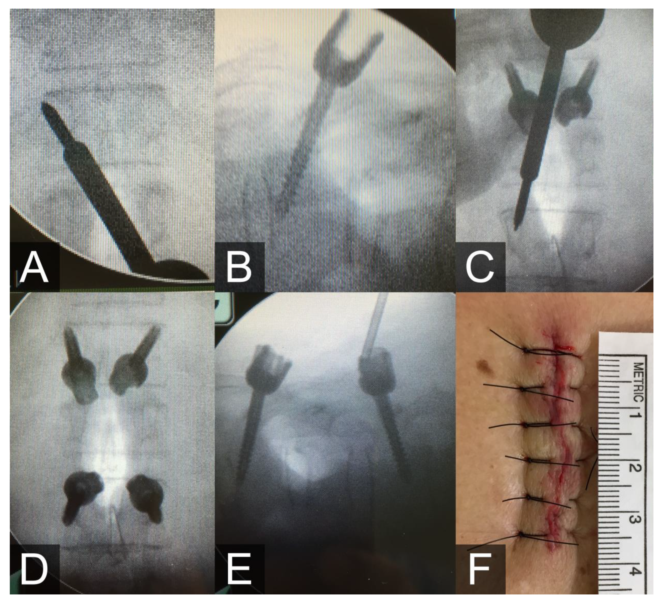 Medicina 56 00082 g002
