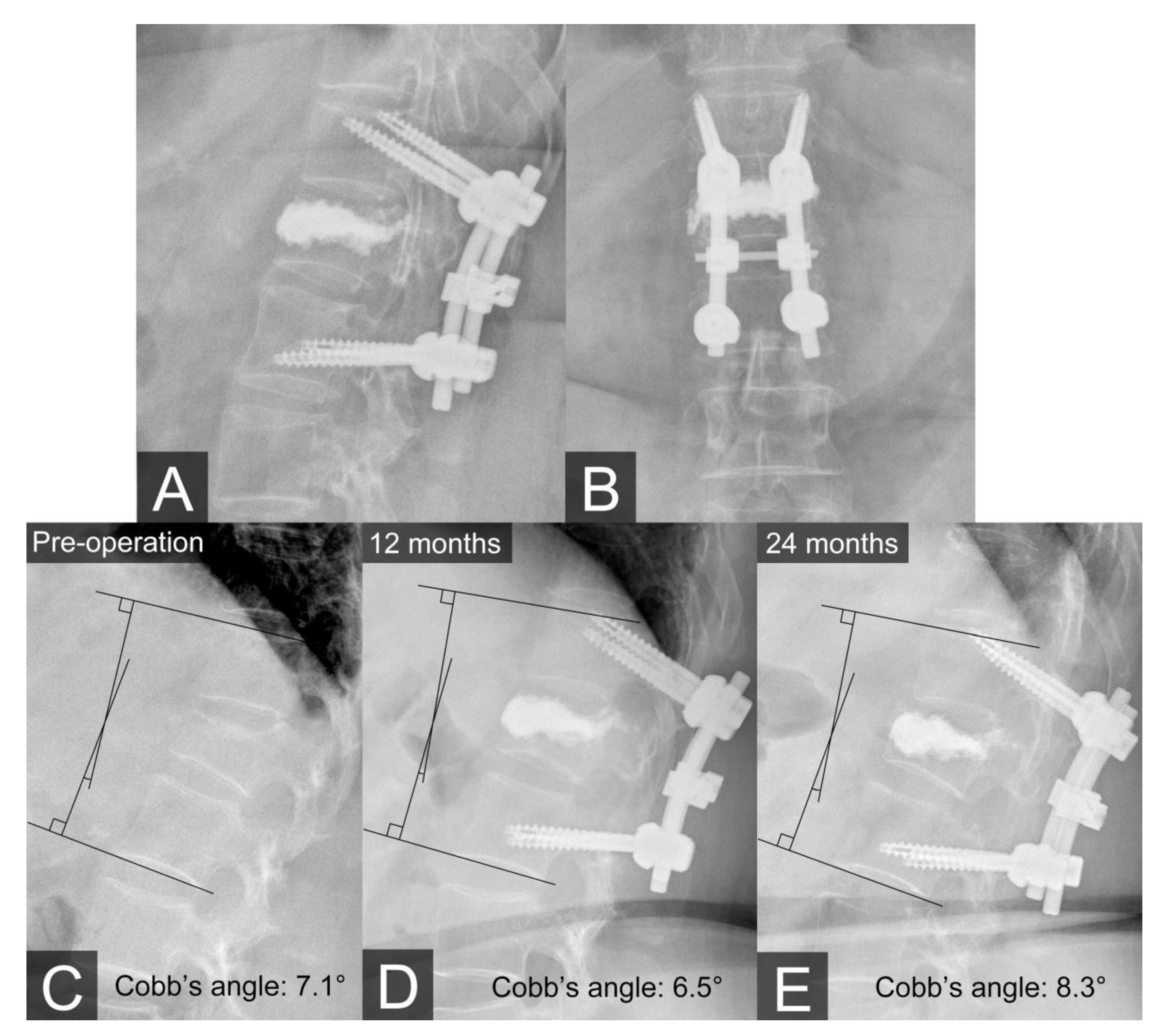 Medicina 56 00082 g003