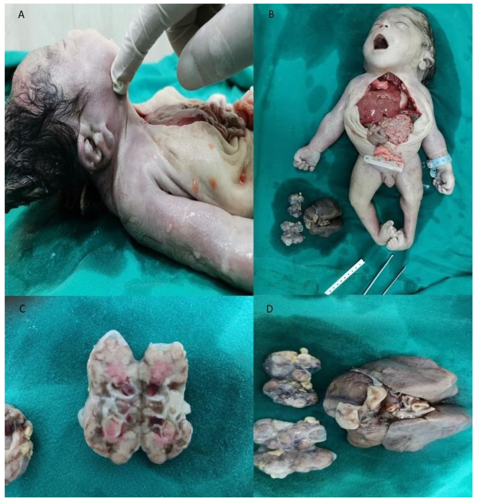 Medicina 56 00109 g002