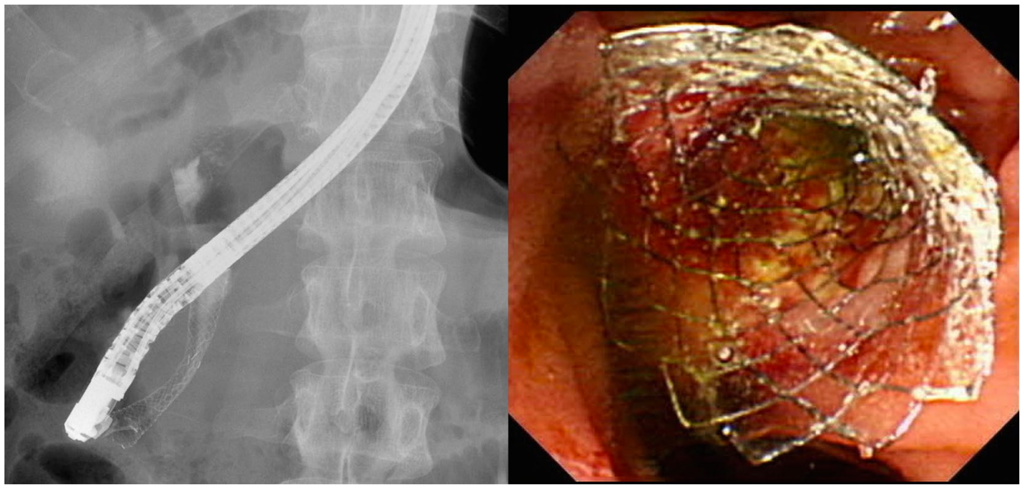 Medicina 56 00114 g002