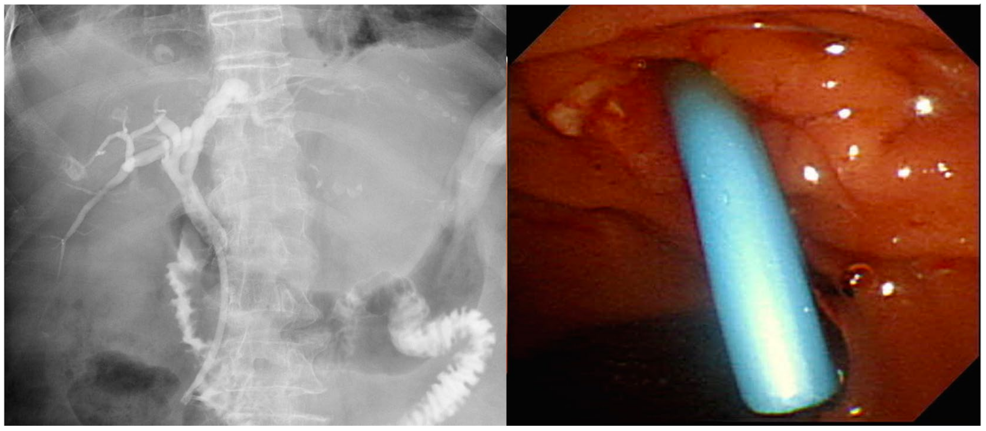 Medicina 56 00114 g003
