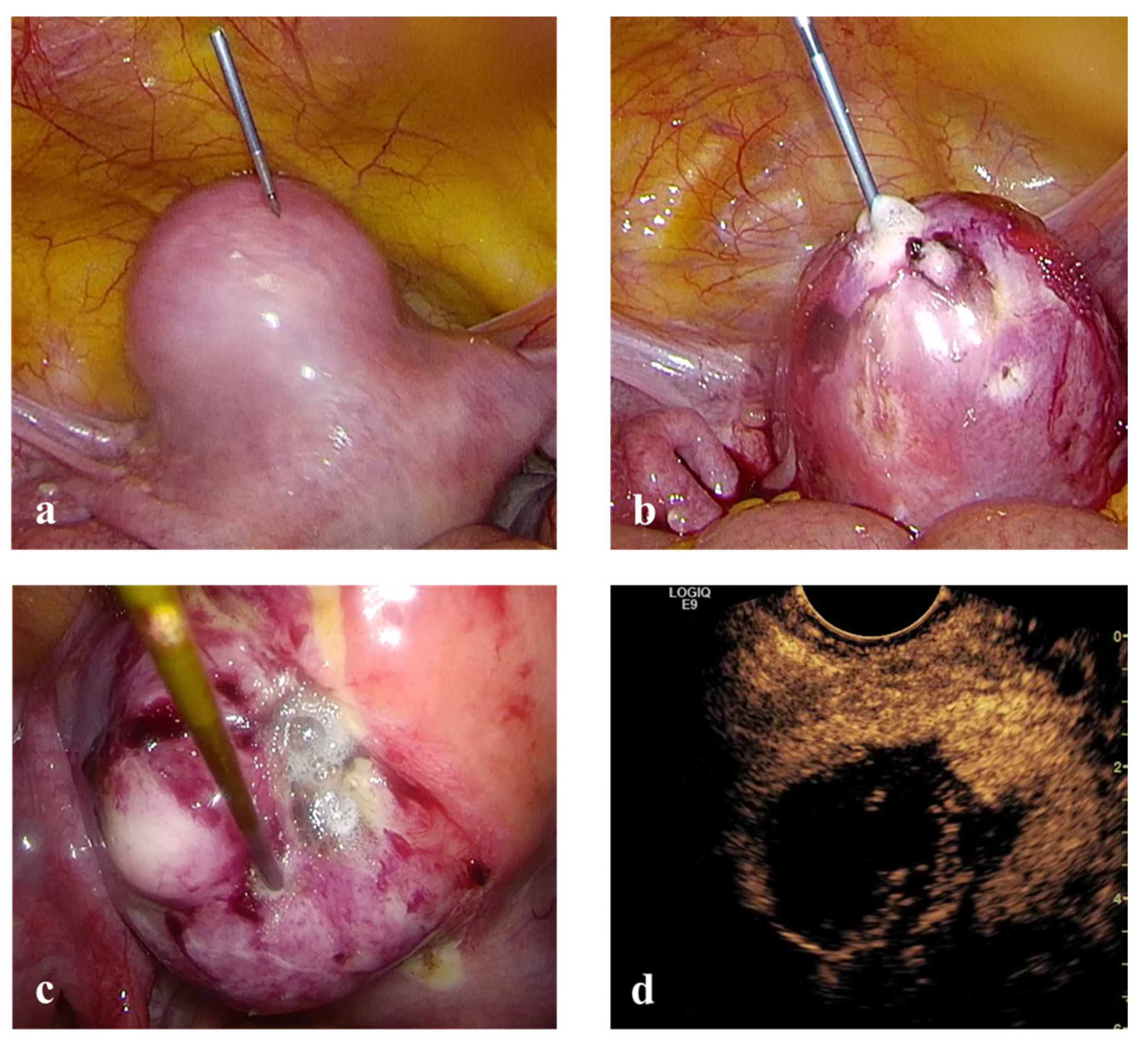 Medicina 56 00122 g003