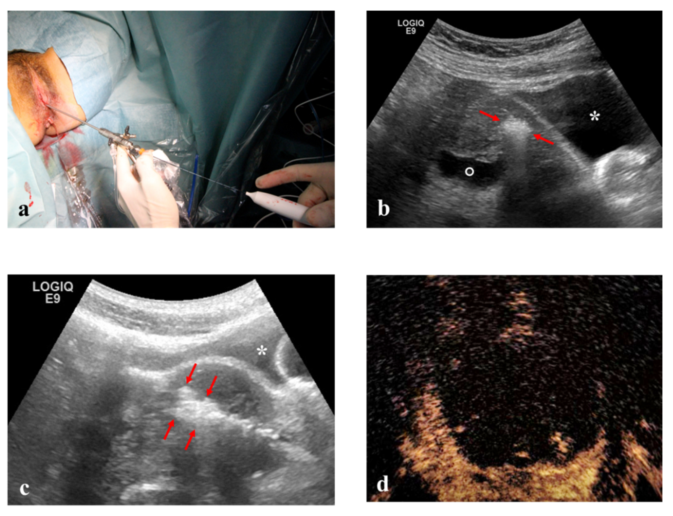Medicina 56 00122 g004