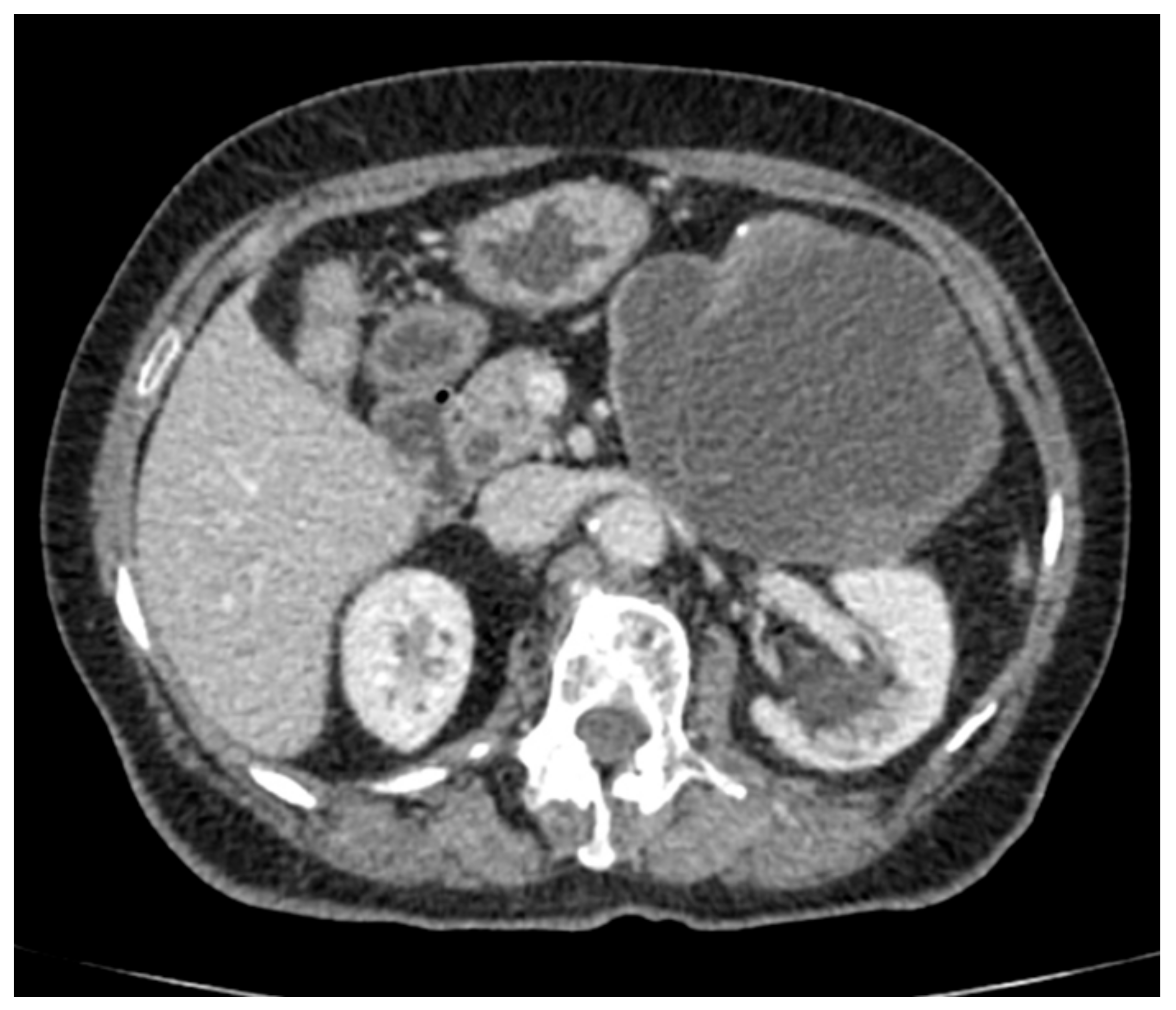 Medicina 56 00124 g002