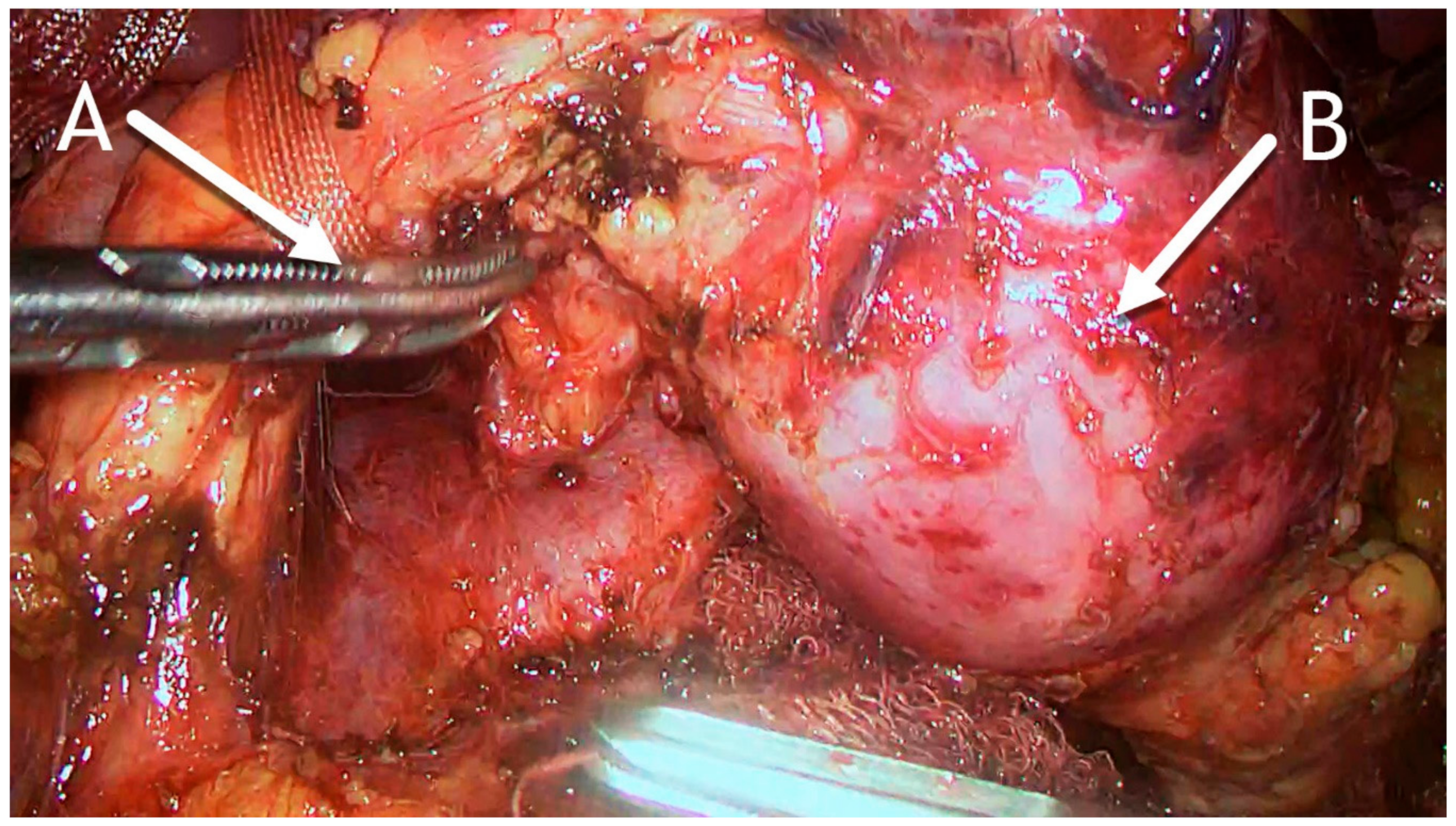 Medicina 56 00124 g005