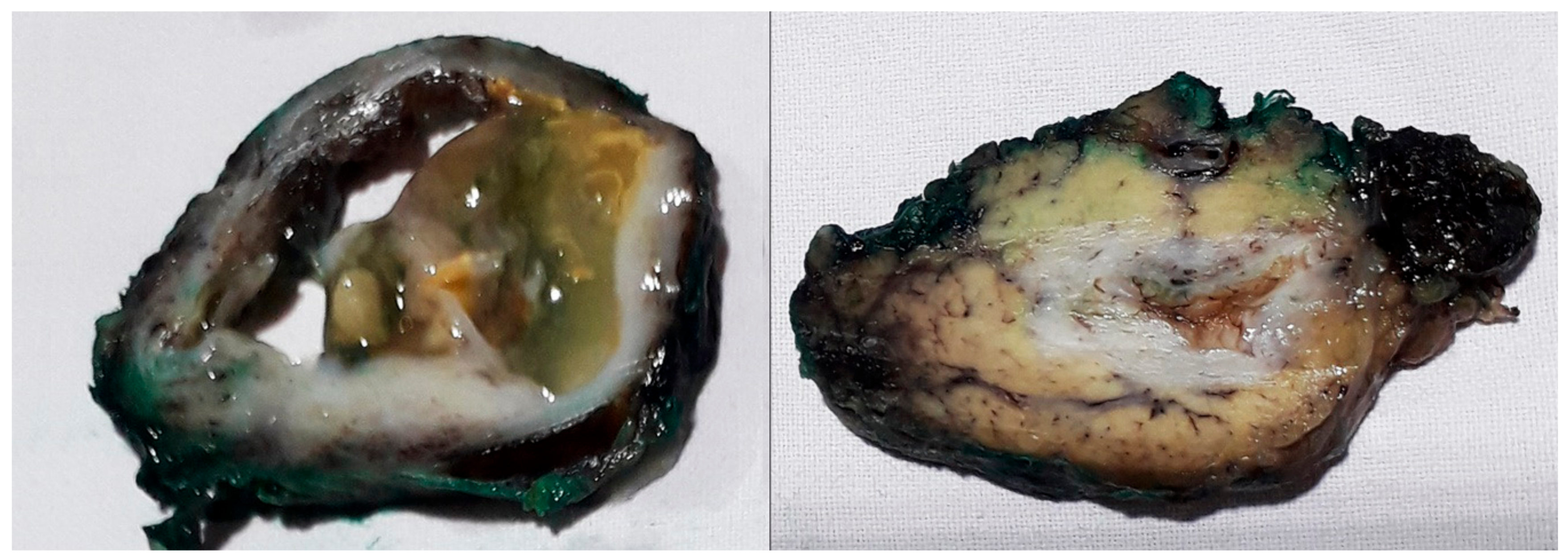 Medicina 56 00124 g006