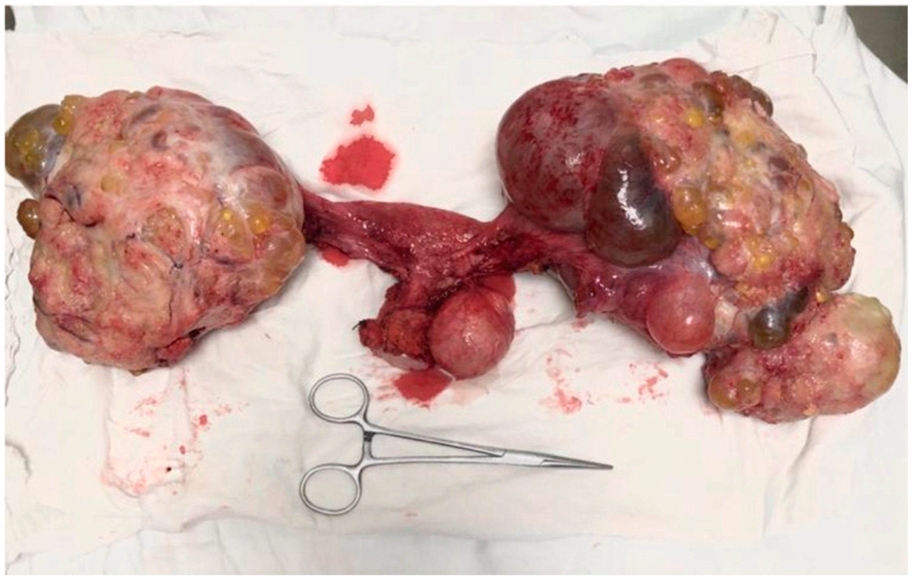 Medicina 56 00152 g002