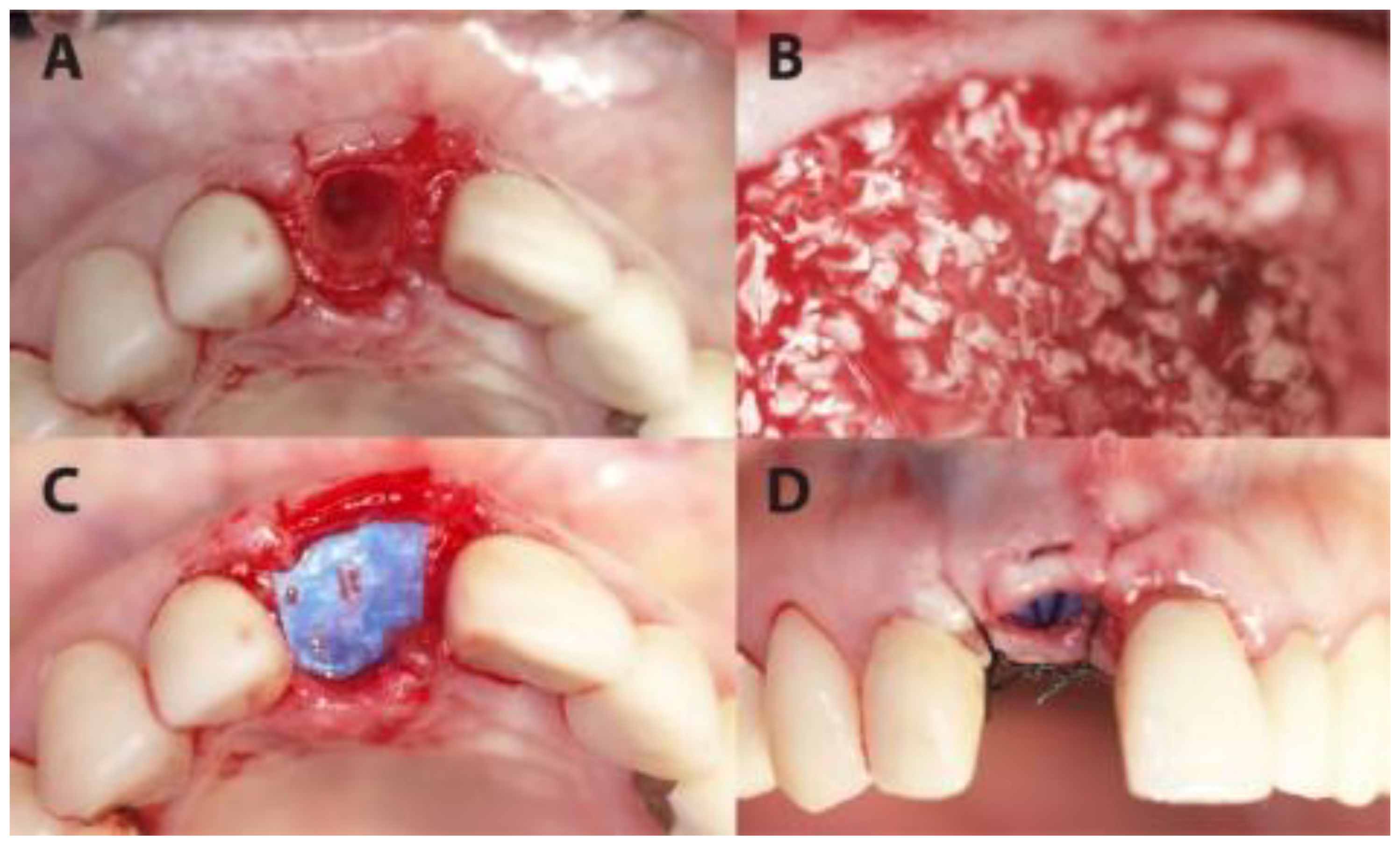Medicina 56 00216 g001