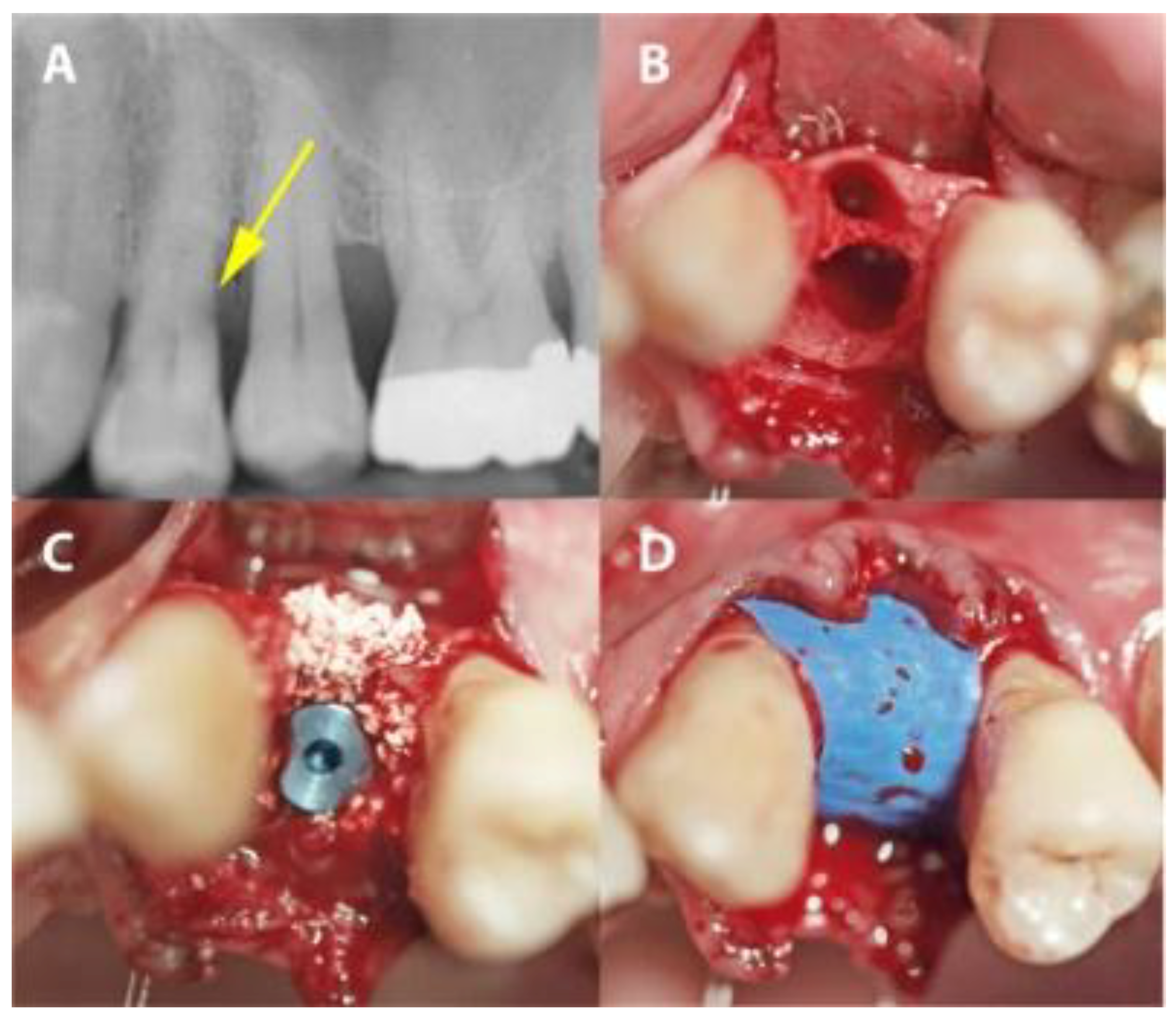 Medicina 56 00216 g003