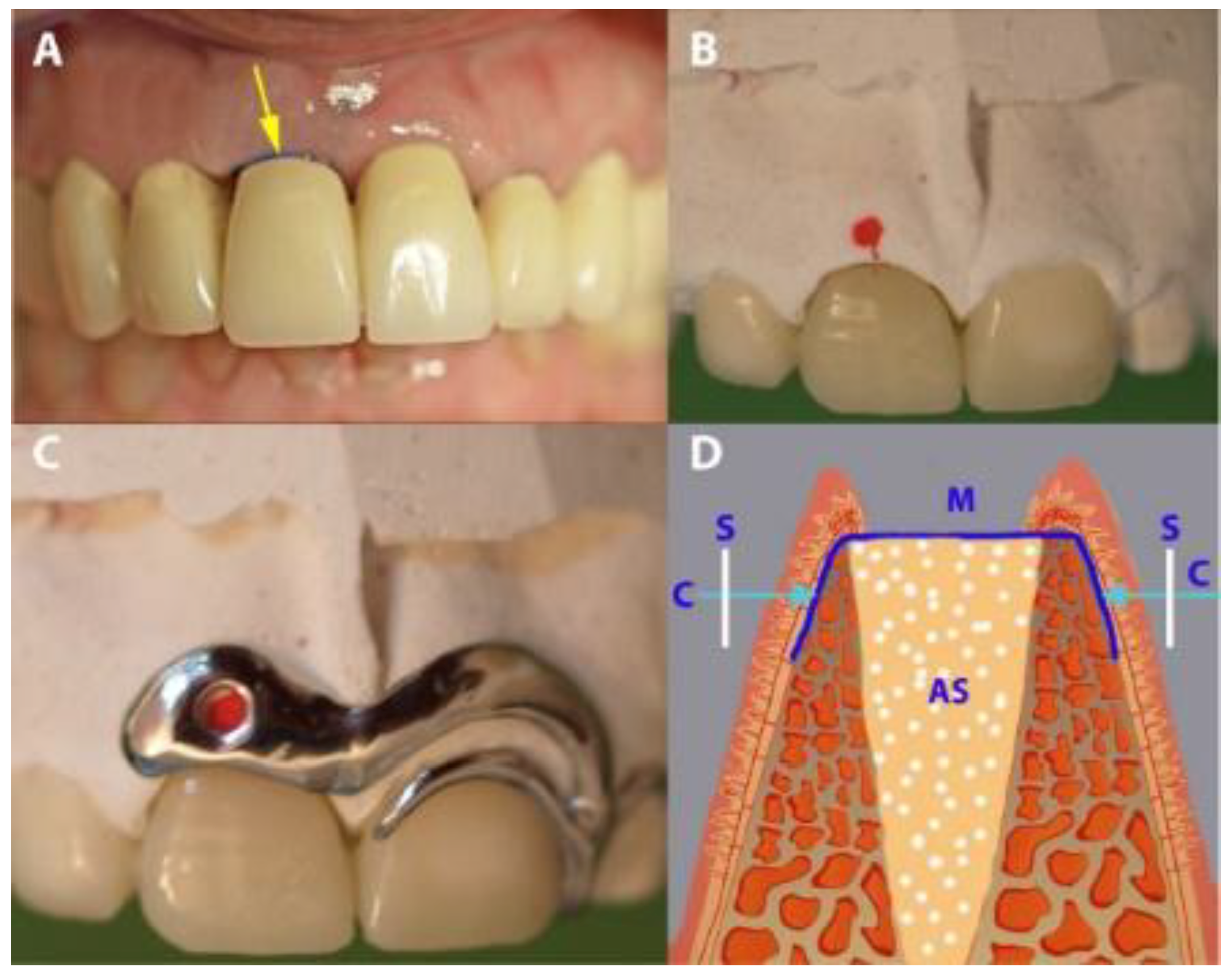 Medicina 56 00216 g005
