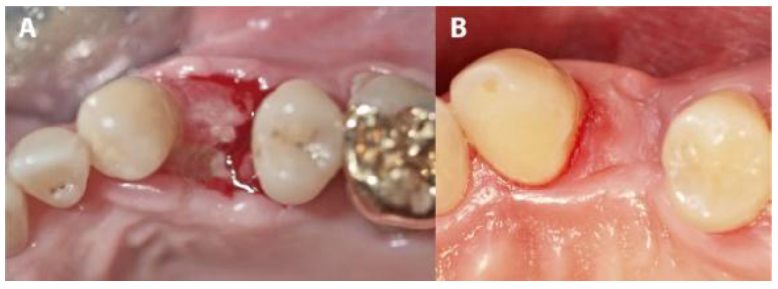 Medicina 56 00216 g007