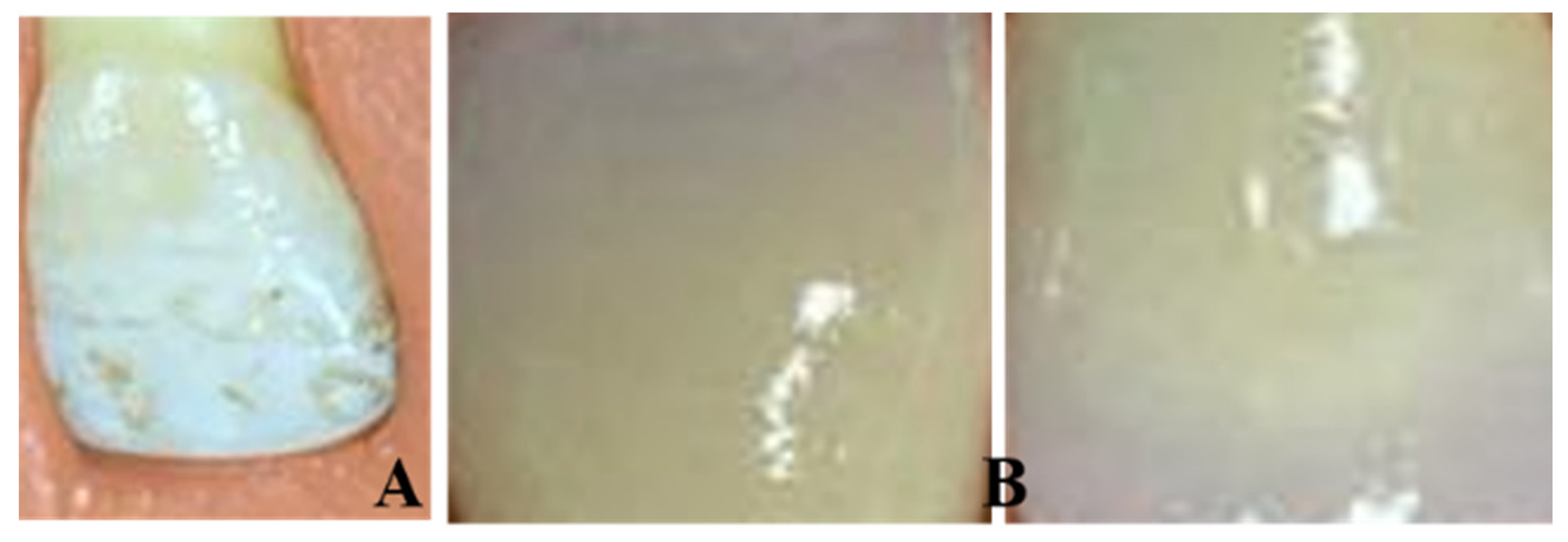 Medicina 56 00234 g001 Medicina 56 00234 g001