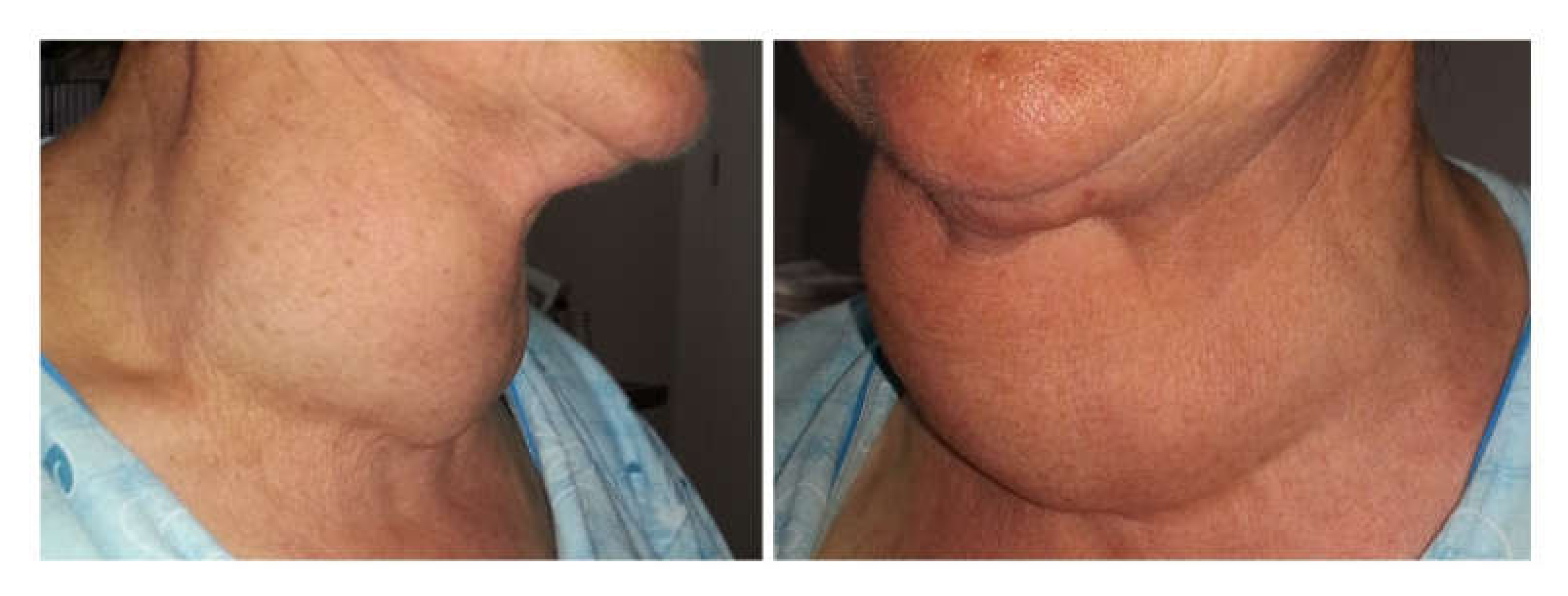 Medicina 56 00290 g001