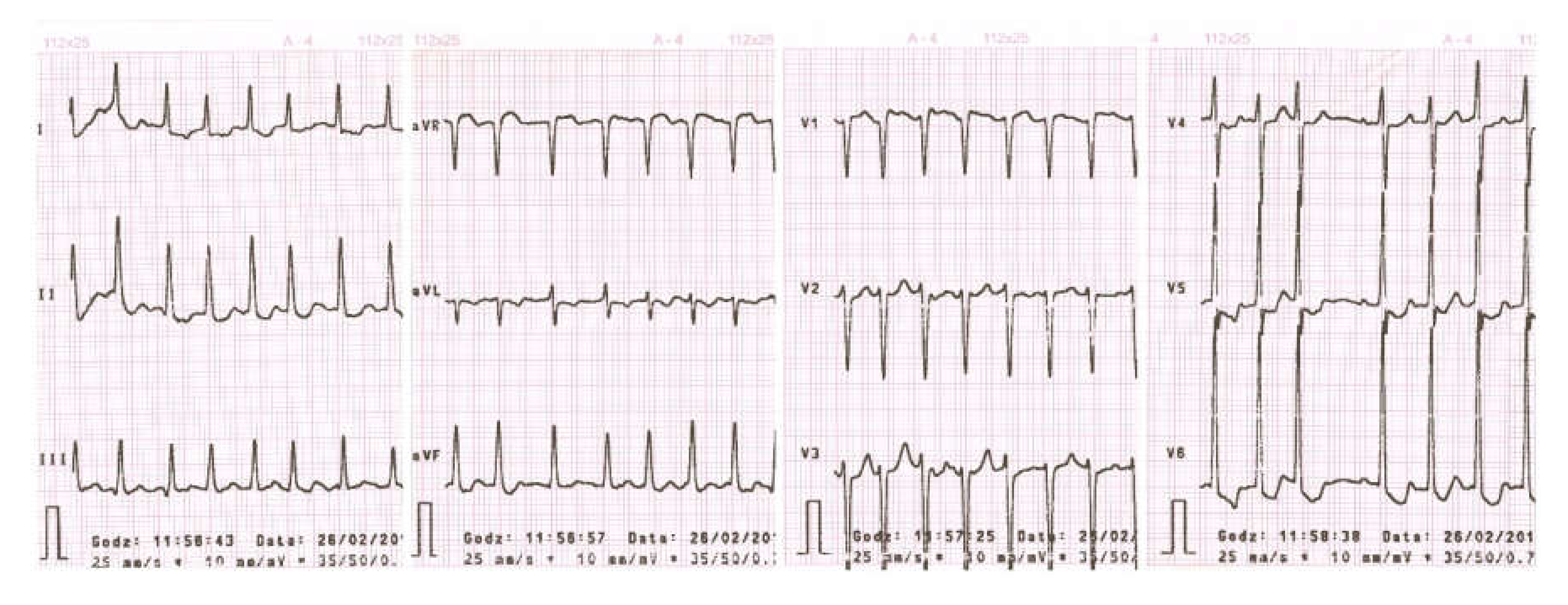 Medicina 56 00290 g002