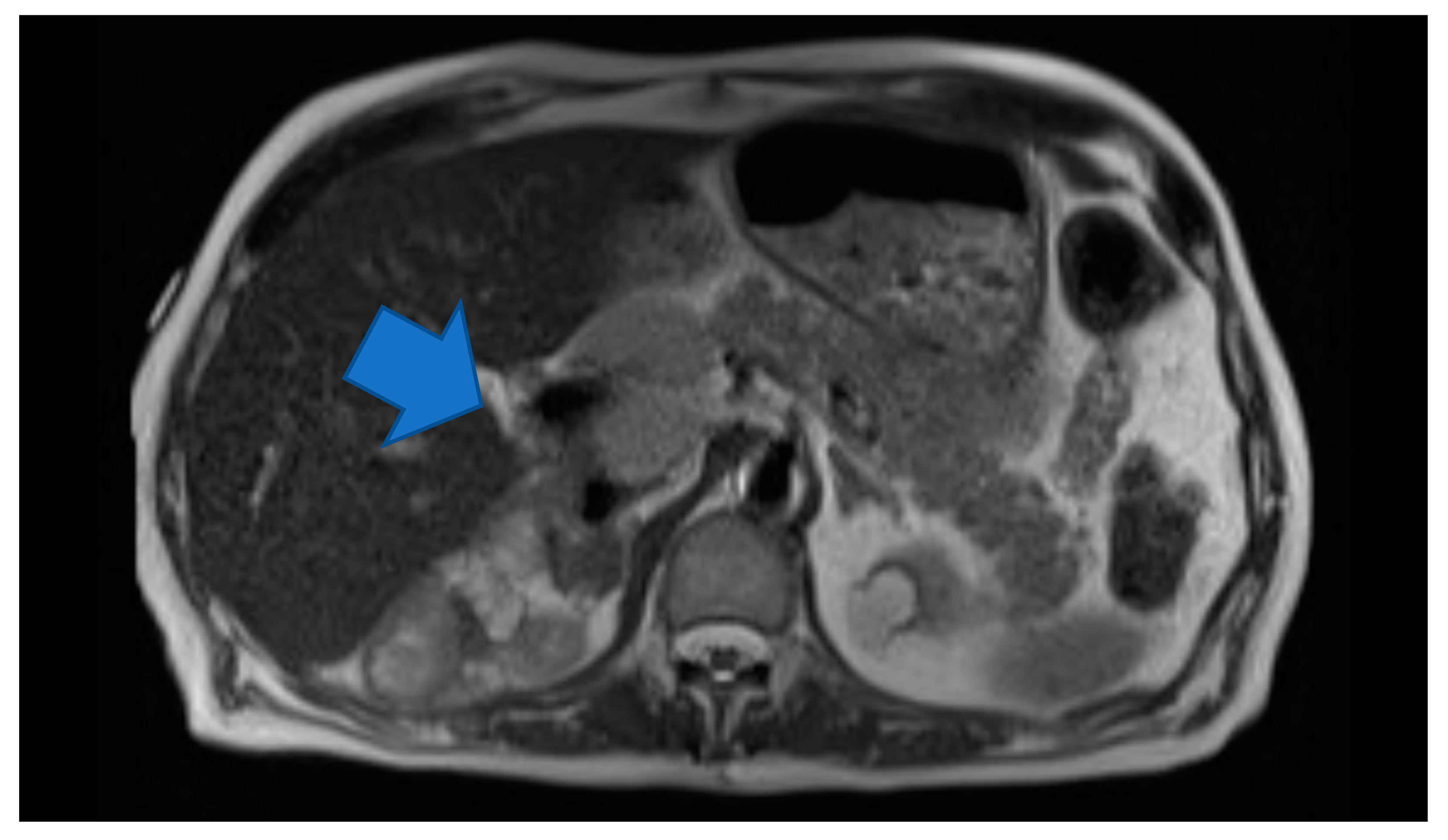 Medicina 56 00316 g001 Medicina 56 00316 g001