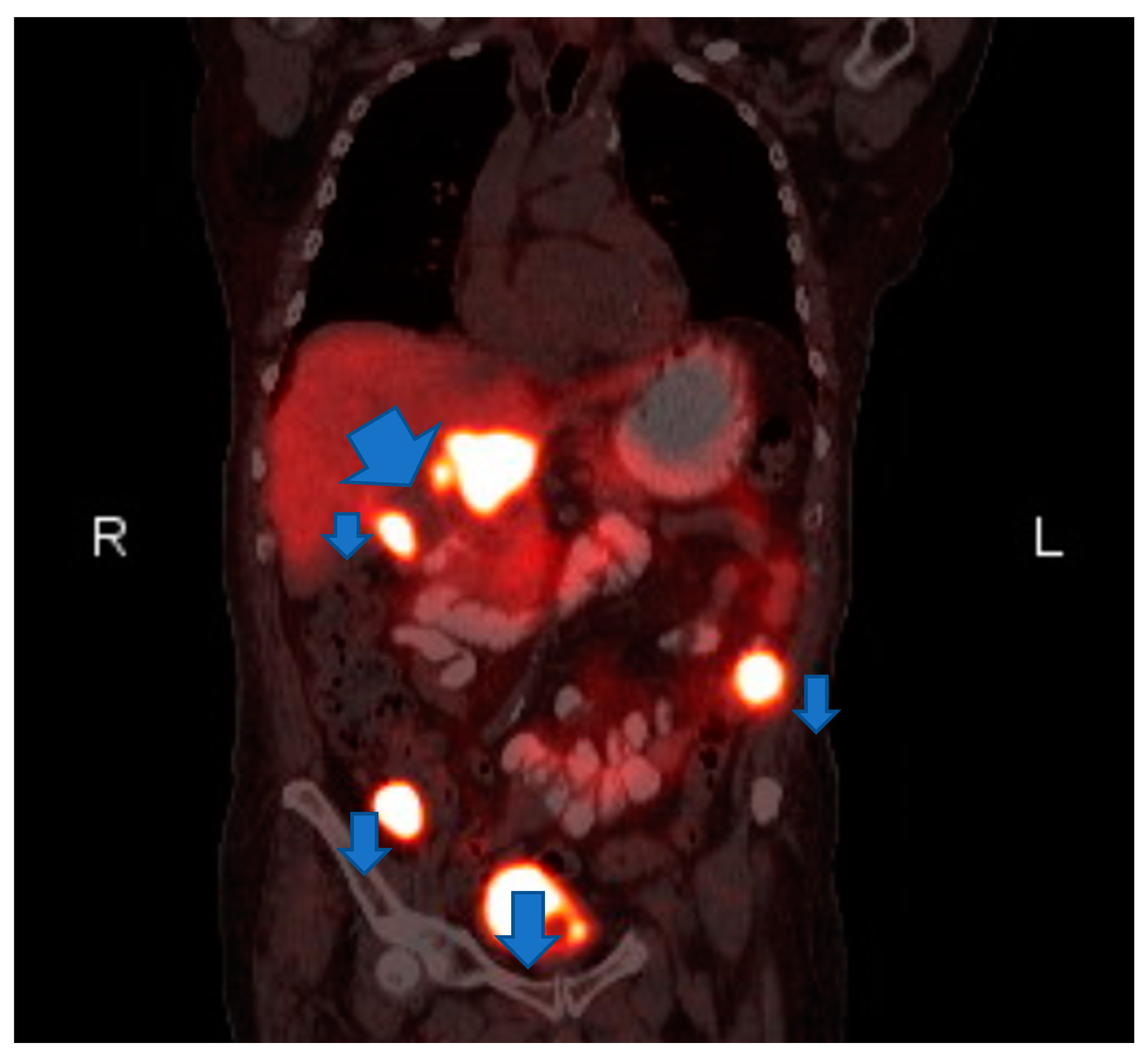 Medicina 56 00316 g002 Medicina 56 00316 g002