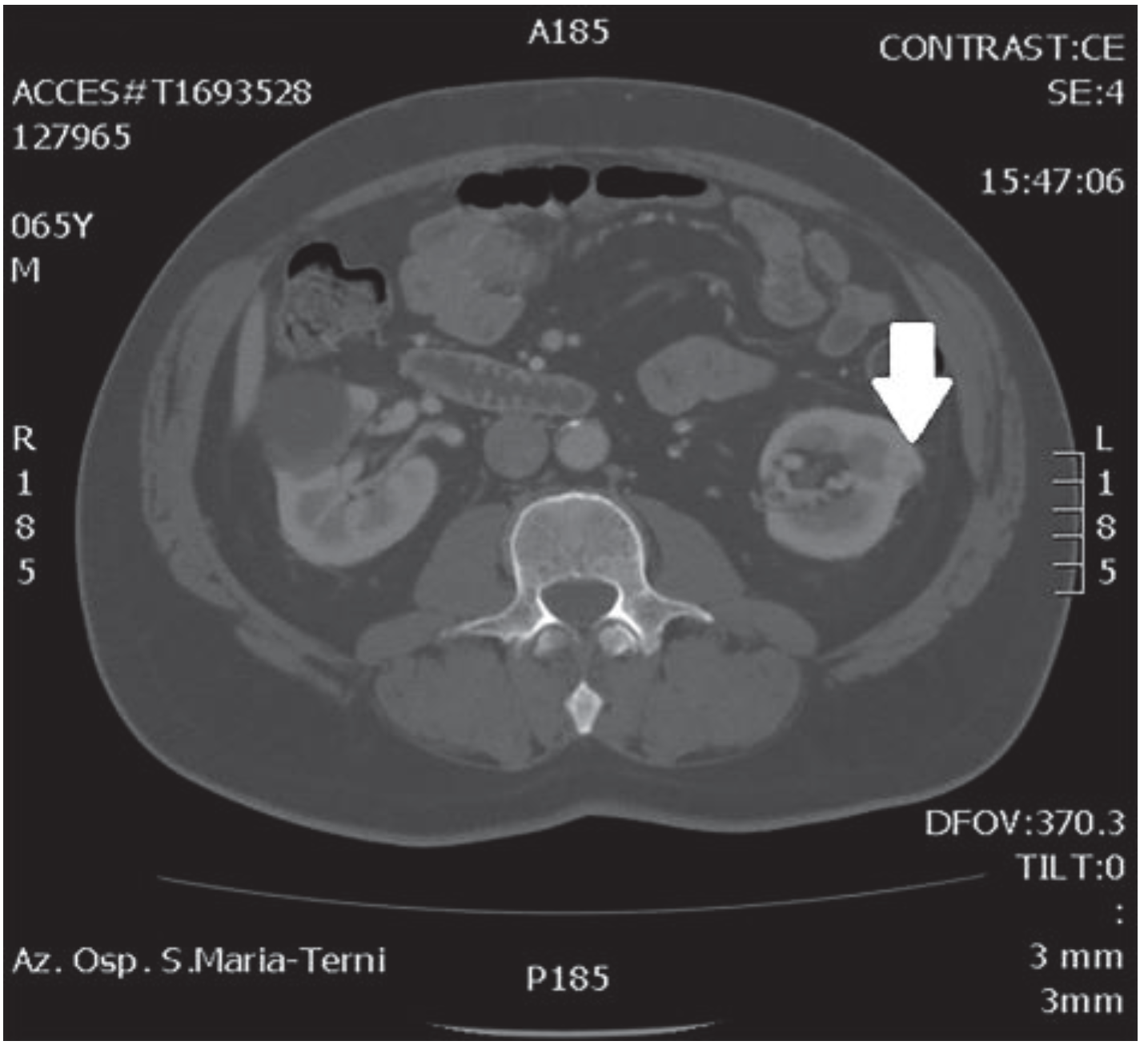 Medicina 56 00318 g001