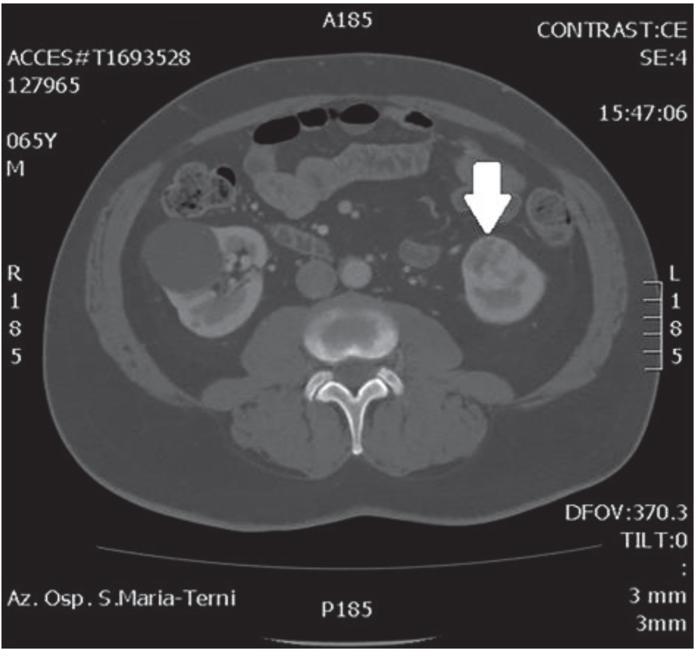 Medicina 56 00318 g002