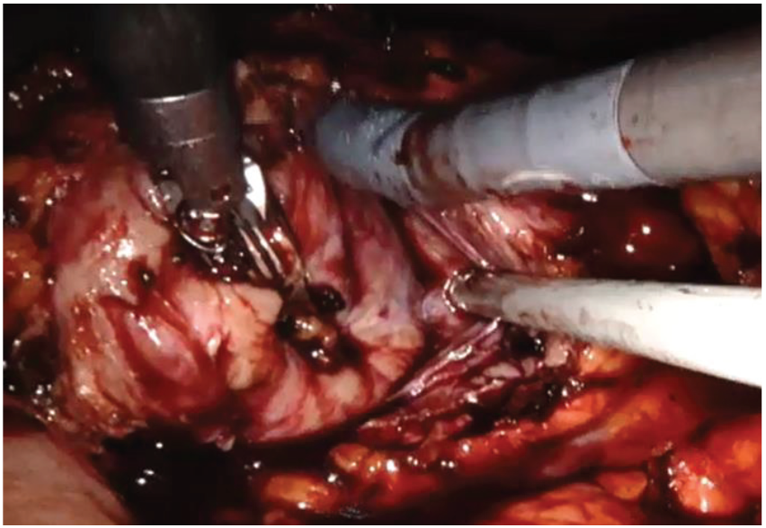 Medicina 56 00318 g004