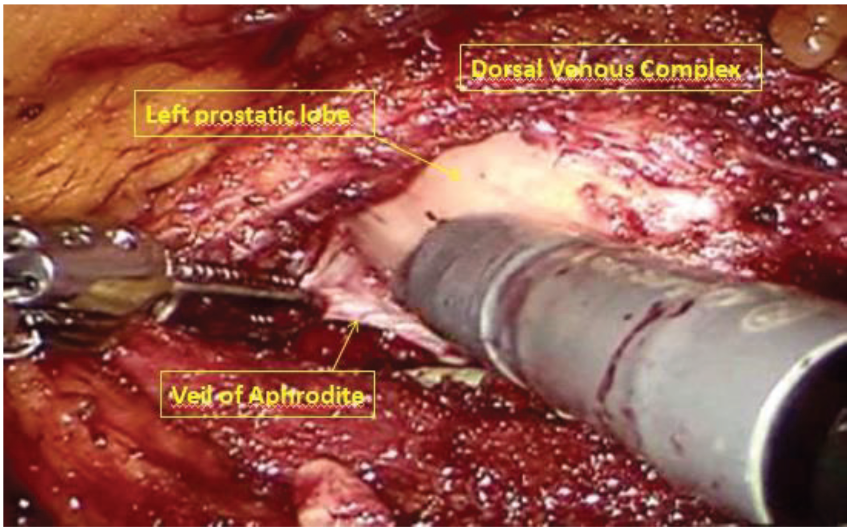 Medicina 56 00318 g005