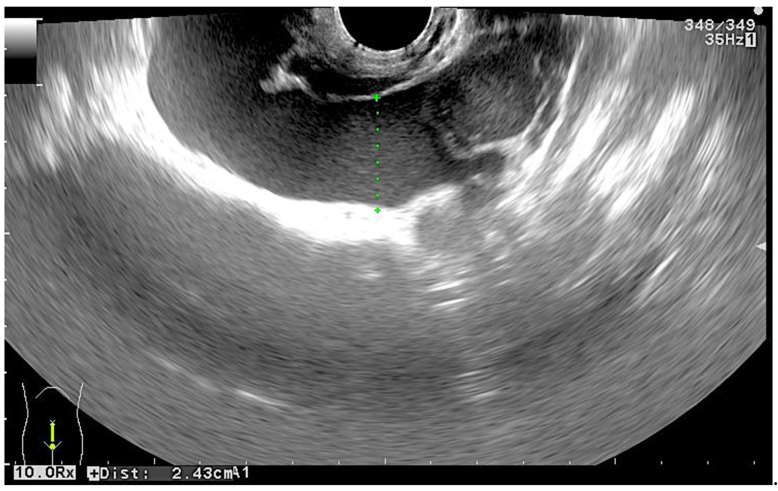 Medicina 56 00365 g002