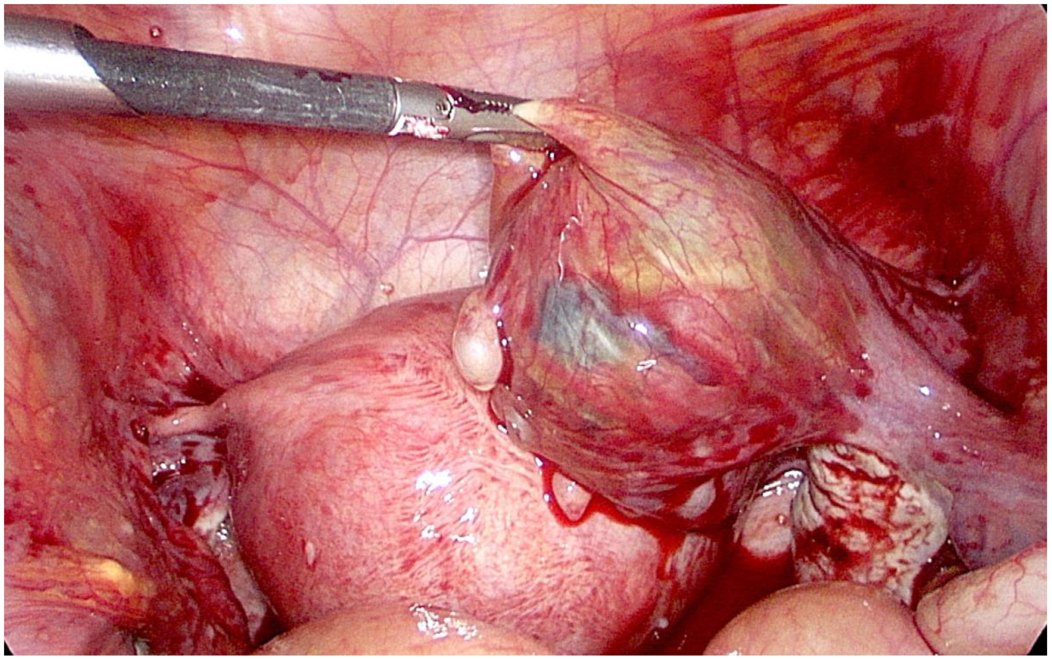 Medicina 56 00365 g003