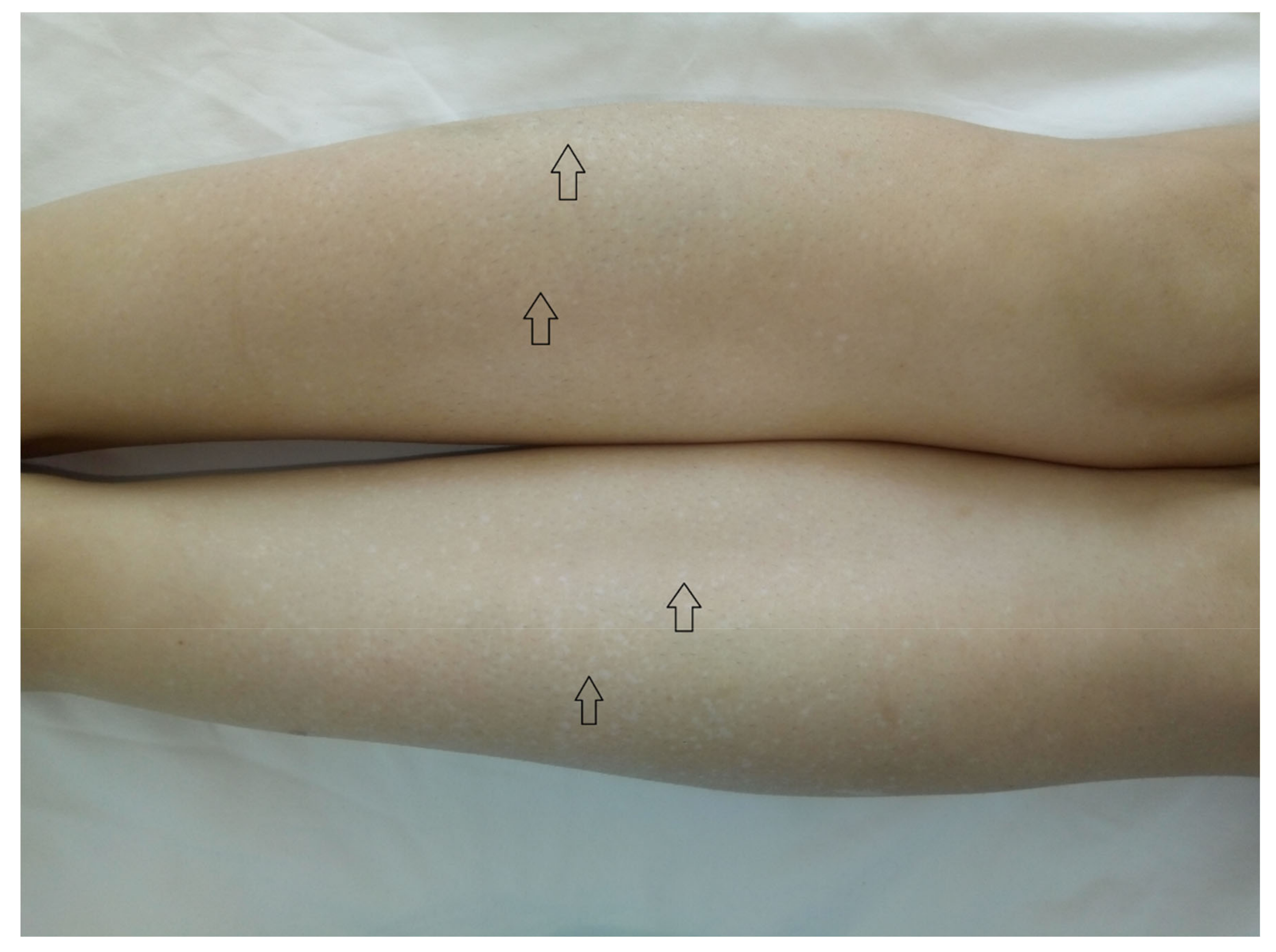 Medicina 56 00369 g003